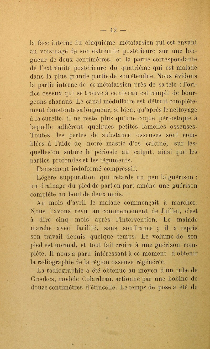 la face interne du cinquième métatarsien qui est envalii au voisinage d,e son extrémité postérieure sur une lon- gueur de deux centimètres, et la partie correspondante de l'extrémité postérieure du quatrième qui est malade dans la plus grande partie de son étendue. Nous évidons la partie interne de ce métatarsien près de sa tête : l'ori- fice osseux qui se tronve à ce niveau est rempli de bour- geons charnus. Le canal médullaire est détruit complète- ment danstoute sa longueur, si bien, qu'après le nettoyage à la curette, il ne reste plus qu'une coque périostique à laquelle adhèrent quelques petites lamelles osseuses. Toutes les pertes de substance osseuses sont com- blées.à l'aide de notre mastic d'os calciné, sur les- quelles'on suture le périoste au catgut, ainsi que les parties profondes et les téguments. Pansement iodoformé compressif. Légère suppuration qui retarde un peu la'guérison : un drainage du pied de part en part amène une guérison complète au bout de deux mois. Au mois d'avril le malade commençait à marcher. Nous l'avons revu au commencement de Juillet, c'est à dire cinq mois après l'intervention. Le malade marche avec facilité, sans souffrance ; il a repris son travail depuis quelque temps. Le volume de son pied est normal, et tout fait croire à une guérison com- plète. Il nous a paru intéressant à ce moment d'obtenir la radiographie de la région osseuse régénérée. La radiographie a été obtenue au mo^^en d'un tube de Grookes, modèle Golardeau, actionné par une bobine de douze centimètres d'étincelle. Le temps de pose a été de
