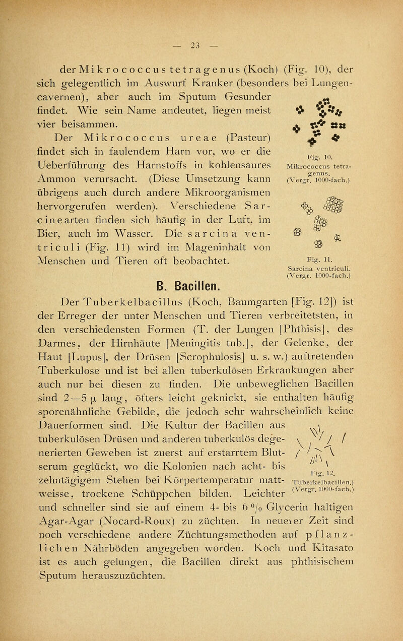 •> ♦ •• ♦' * Fig-. 10. Mikrococcus tetra- genus. (Vero :r. 1000-fach.) — 23 — der Mi k r o c o c c u s te t r age n US (Koch) (Fig. 10), der sich gelegentlich im Auswurf Kranker (besonders bei Lungen- cavernen), aber auch im Sputum Gesunder findet. Wie sein Name andeutet, liegen meist vier beisammen. Der Mikrococcus ureae (Pasteur) findet sich in faulendem Harn vor, wo er die Ueberführung des Harnstoffs in kohlensaures Ammon verursacht. (Diese Umsetzung kann übrio-ens auch durch andere Mikroorp'anismen hervorgerufen werden). Verschiedene Sar- <fe^ ^^ eine arten finden sich häufig in der Luft, im ^ Bier, auch im Wasser, Die sarcinaven- ® ^ triculi (Fig. 11) wird im Mageninhalt von ® Menschen und Tieren oft beobachtet. ^'^s- ^^■ Sarcina ventriculi. (Verg-r. 1000-fach.) B. Baciilen. Der Tuberkelbacillus (Koch, Baumgarten [Fig. 12]) ist der Erreger der unter Menschen und Tieren verbreitetsten, in den verschiedensten Formen (T. der Lungen [Phthisis], des Darmes, der Hirnhäute [Meningitis tub.], der Gelenke, der Haut [Lupus], der Drüsen [Scrophulosis] u. s. w.) auftretenden Tuberkulose und ist bei allen tuberkulösen Erkrankungen aber auch nur bei diesen zu finden. Die unbeweglichen Bacillen sind 2—5 [i lang, öfters leicht geknickt, sie enthalten häufig sporenähnliche Gebilde, die jedoch sehr wahrscheinlich keine Dauerformen sind. Die Kultur der Bacillen aus ^ tuberkulösen Drüsen und anderen tuberkulös dege- \ ' / f nerierten Geweben ist zuerst auf erstarrtem Blut- / i\ ^ serum p'ep'lückt, wo die Kolonien nach acht- bis ^ . c^ . Fig-. 12. zehntägigem Stehen bei Körpertemperatur matt- TuberkeibaciUen.) weisse, trockene Schüppchen bilden. Leichter * '^'^^''• und schneller sind sie auf einem 4- bis 6 ^/o Glycerin haltigen Agar-Agar (Nocard-Roux) zu züchten. In neueier Zeit sind noch verschiedene andere Züchtungsmethoden auf pflanz- lichen Nährböden angegeben worden. Koch und Kitasato ist es auch gelungen, die Bacillen direkt aus phthisischem Sputum herauszuzüchten.