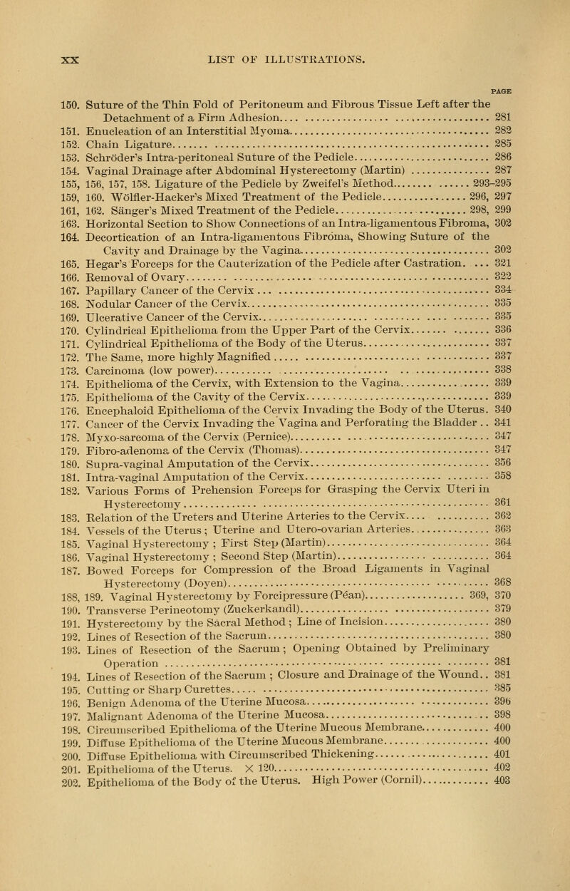 150. Suture of the Thin Fold of Peritoneum and Fibrous Tissue Left after the Detachment of a Firm Adhesion 281 151. Enucleation of an Interstitial Myoma 282 152. Chain Ligature 285 153. Schroder's Intra-peritoneal Suture of the Pedicle 286 154. Vaginal Drainage after Abdominal Hysterectomy (Martin) 287 155. 156, 157, 158. Ligature of the Pedicle by Zweifel's Method 293-295 159, 160. Welfler-Hacker's Mixed Treatment of the Pedicle 296, 297 161, 162. Sanger's Mixed Treatment of the Pedicle 298, 299 163. Horizontal Section to Show Connections of an Intra-ligamentous Fibroma, 302 164. Decortication of an Intra-ligamentous Fibroma, Showing Suture of the Cavity and Drainage by the Vagina 302 165. Hegar's Forceps for the Cauterization of the Pedicle after Castration. 321 166. Removal of Ovary .. 322 167. Papillary Cancer of the Cervix 334 168. Nodular Cancer of the Cervix ,..,,.., 335 169. Ulcerative Cancer of the Cervix. 335 170. Cylindrical Epithelioma from the Upper Part of the Cervix 336 171. Cylindrical Epithelioma of the Body of the Uterus 337 172. The Same, more highly Magnified 337 173. Carcinoma (low power) 338 174. Epithelioma of the Cervix, with Extension to the Vagina 339 175. Epithelioma of the Cavity of the Cervix , 339 176. Encephaloid Epithelioma of the Cervix Invading the Body of the Uterus. 340 177. Cancer of the Cervix Invading the Vagina and Perforating the Bladder .. 341 178. Myxo-sarcoma of the Cervix (Pernice) 347 179. Fibro-adenoma of the Cervix (Thomas) 347 180. Supra-vaginal Amputation of the Cervix 356 181. Intra-vaginal Amputation of the Cervix 358 182. Various Forms of Prehension Forceps for Grasping the Cervix Uteri in Hysterectomy 361 183. Relation of the Ureters and Uterine Arteries to the Cervix 362 184. Vessels of the Uterus ; Uterine and Utero-ovarian Arteries 363 185. Vaginal Hysterectomy ; First Step (Martin) 364 186. Vaginal Hysterectomy ; Second Step (Martin) 364 187. Bowed Forceps for Compression of the Broad Ligaments in Vaginal Hysterectomy (Doyen) 368 188. 189. Vaginal Hysterectomy by Forcipressure (Pean) 369, 370 190. Transverse Perineotomy (Zuckerkandl) 379 191. Hysterectomy by the Sacral Method ; Line of Incision 380 192. Lines of Resection of the Sacrum 380 193. Lines of Resection of the Sacrum; Opening Obtained by Preliminary Operation 381 194. Lines of Resection of the Sacrum ; Closure and Drainage of the Wound.. 381 195. Cutting or Sharp Curettes 385 196. Benign Adenoma of the Uterine Mucosa 396 197. Malignant Adenoma of the Uterine Mucosa 398 198. Circumscribed Epithelioma of the Uterine Mucous Membrane 400 199. Diffuse Epithelioma of the Uterine Mucous Membrane 400 200. Diffuse Epithelioma with Circumscribed Thickening 401 201. Epithelioma of the Uterus. X 120 402 202. Epithelioma of the Body of the Uterus. High Power (Cornil) 403