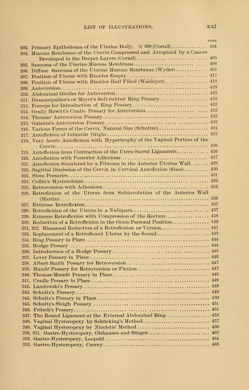 203. Primary Epithelioma of the Uterine Body. X 300 (Cornil) 404 204. Mucous Membrane of the Cervix Compressed and Atrophied by a Cancer Developed in the Deeper Layers (Cornil) 405 205. Sarcoma of the Uterine Mucous Membrane 406 206. Diffuse Sarcoma of the Uterine Mucous Membrane (Wyder) 407 207. Position of Uterus with Bladder Empty 417 208. Position of Uterus with Bladder Half Filled (Waldeyer) 418 209. Anteversion 420 210. Abdominal Girdles for Anteversion 422 211. Dumontpallier's or Meyer's Soft-rubber Ring Pessary -422 212. Forceps for Introduction of Ring Pessary 422 213. Graily Hewitt's Cradle Pessary for Anteversion ... 423 214. Thomas' Anteversion Pessary 423 215. Galabin's Anteversion Pessary 423 216. Various Forms of the Cervix, Natural Size (Schultze) 424 217. Anteflexion of Infantile Origin - 425 218. Very Acute Anteflexion with Hypertrophy of the Vaginal Portion of the Cervix : 426 219. Anteflexion from Contraction of the Utero-Sacral Ligaments 426 220. Anteflexion with Posterior Adhesions 427 221. Anteflexion Simulated by a Fibroma in the Anterior Uterine Wall 428 222. Sagittal Discission of the Cervix in Cervical Anteflexion (Sims) 430 223. Stem Pessaries 431 224. Collin's Hysterotome 432 225. Retroversion with Adhesions 434 226. Retroflexion of the Uterus from Subinvolution of the Anterior Wall (Martin) 436 227. Extreme Retroflexion 437 228. Retroflexion of the Uterus in a Nullipara , 437 229. Extreme Retroflexion with Compression of the Rectum 438 230. Reduction of a Retroflexion in the Genu-Pectoral Position 440 231. 232. Bimanual Reduction of a Retroflexion or Version 441 233. Replacement of a Retroflexed Uterus by the Sound 443 234. Ring Pessary in Place 444 235. Hodge Pessary . 444 236. Introduction of a Hodge Pessary 445 237. Lever Pessary in Place 446 238. Albert Smith Pessary for Retroversion 447 239. Mund6 Pessary for Retroversion or Flexion 447 240. Thomas-Munde Pessary in Place 448 241. Cradle Pessary in Place 449 242. Landowski's Pessary 449 243. Schultz's Pessary 449 244. Schultz's Pessary in Place 450 245. Schultz's Sleigh Pessary 451 246. Fritsch's Pessary : 451 247. The Round Ligament at the External Abdominal Ring 453 248. Vaginal Hysteropexy by Schtlcking's Method 457 249. Vaginal Hysteropexy by Nicoletis' Method 459 250. 251. Gastro-Hysteropexy, Olshausen and Sanger 462 252. Gastro-Hysteropexy, Leopold 464 253. Gastro-Hysteropexy, Czerny 465