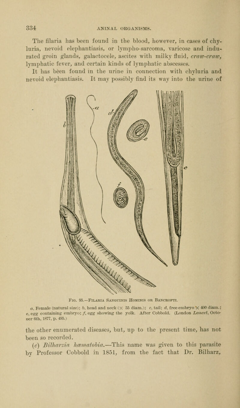 The tilaria has been found in the blood, however, in cases of chy- luria. nevoid elephantiasis, <>r lympho-sarcoma, varicose and indu- rated groin glands, galactocele, ascites with milky fluid, craw-craw, lymphatic fever, and certain kinds of lymphatic abfi - - It has been found in the urine in connection with chvluria and nevoid elephantiasis. It may possibly find its way into the urine of Fig. 95.—Filaria Sanguinis Hosirxis or Bancrofti. a. Female (natural size i: b. head and neck (X •>.> diam. : <•'. tail: il. free embryo X 400 iliam.: e. egg containing embryo; /, egg showing the yolk. After Cobbold. (London Lancet, Octo- oer6th. 1877, p. 49E the other enumerated diseases, but, up to the present time, has not been so recorded. (c) Bilharzia hmmatobia.—This name was given to this parasite bv Professor Cobbold in 1851, from the fact that Dr. Bilharz,