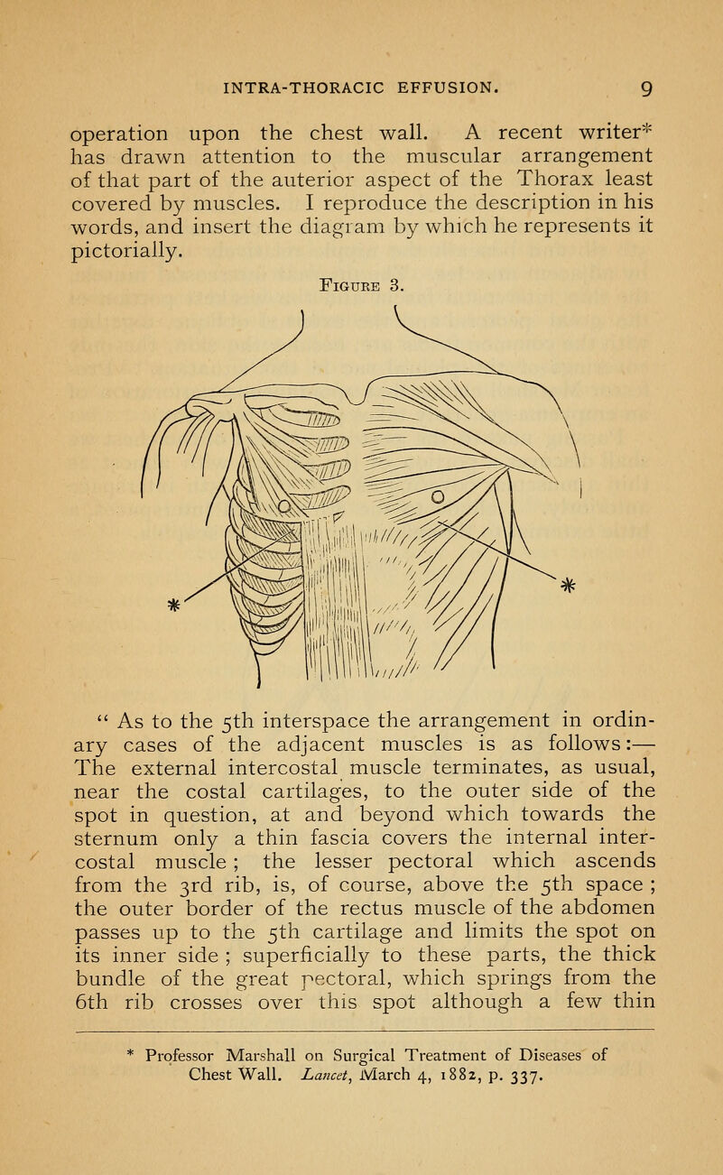 operation upon the chest wall. A recent writer* has drawn attention to the muscular arrangement of that part of the anterior aspect of the Thorax least covered by muscles. I reproduce the description in his words, and insert the diagram by which he represents it pictorially. FiGUKE 3.  As to the 5th interspace the arrangement in ordin- ary cases of the adjacent muscles is as follows:— The external intercostal muscle terminates, as usual, near the costal cartilages, to the outer side of the spot in question, at and beyond which towards the sternum only a thin fascia covers the internal inter- costal muscle ; the lesser pectoral which ascends from the 3rd rib, is, of course, above the 5th space ; the outer border of the rectus muscle of the abdomen passes up to the 5th cartilage and limits the spot on its inner side ; superficially to these parts, the thick bundle of the great pectoral, which springs from the 6th rib crosses over this spot although a few thin * Professor Marshall on Surgical Treatment of Diseases of Chest Wall. Lancet^ March 4, 1882, p. 337.