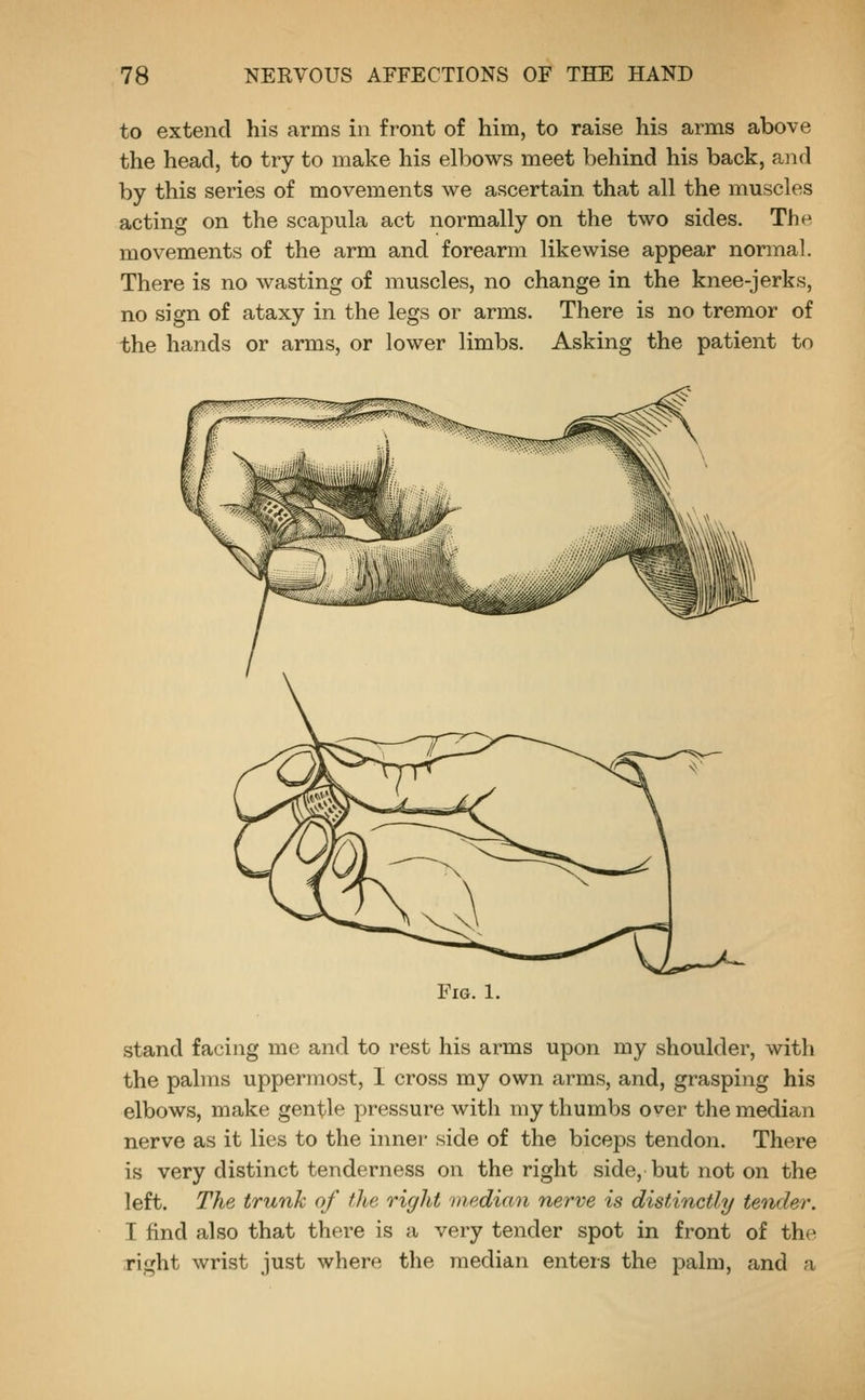 to extend his arms in front of him, to raise his arms above the head, to try to make his elbows meet behind his back, and by this series of movements we ascertain that all the muscles acting on the scapula act normally on the two sides. The movements of the arm and forearm likewise appear normal. There is no wasting of muscles, no change in the knee-jerks, no sign of ataxy in the legs or arms. There is no tremor of the hands or arms, or lower limbs. Asking the patient to VX^A^ Fig. 1. stand facing me and to rest his arms upon my shoulder, with the palms uppermost, I cross my own arms, and, grasping his elbows, make gentle pressure with my thumbs over the median nerve as it lies to the inner- side of the biceps tendon. There is very distinct tenderness on the right side, but not on the left. The trunk of the right median nerve is distinctly tender. I find also that there is a very tender spot in front of the right wrist just where the median enters the palm, and a