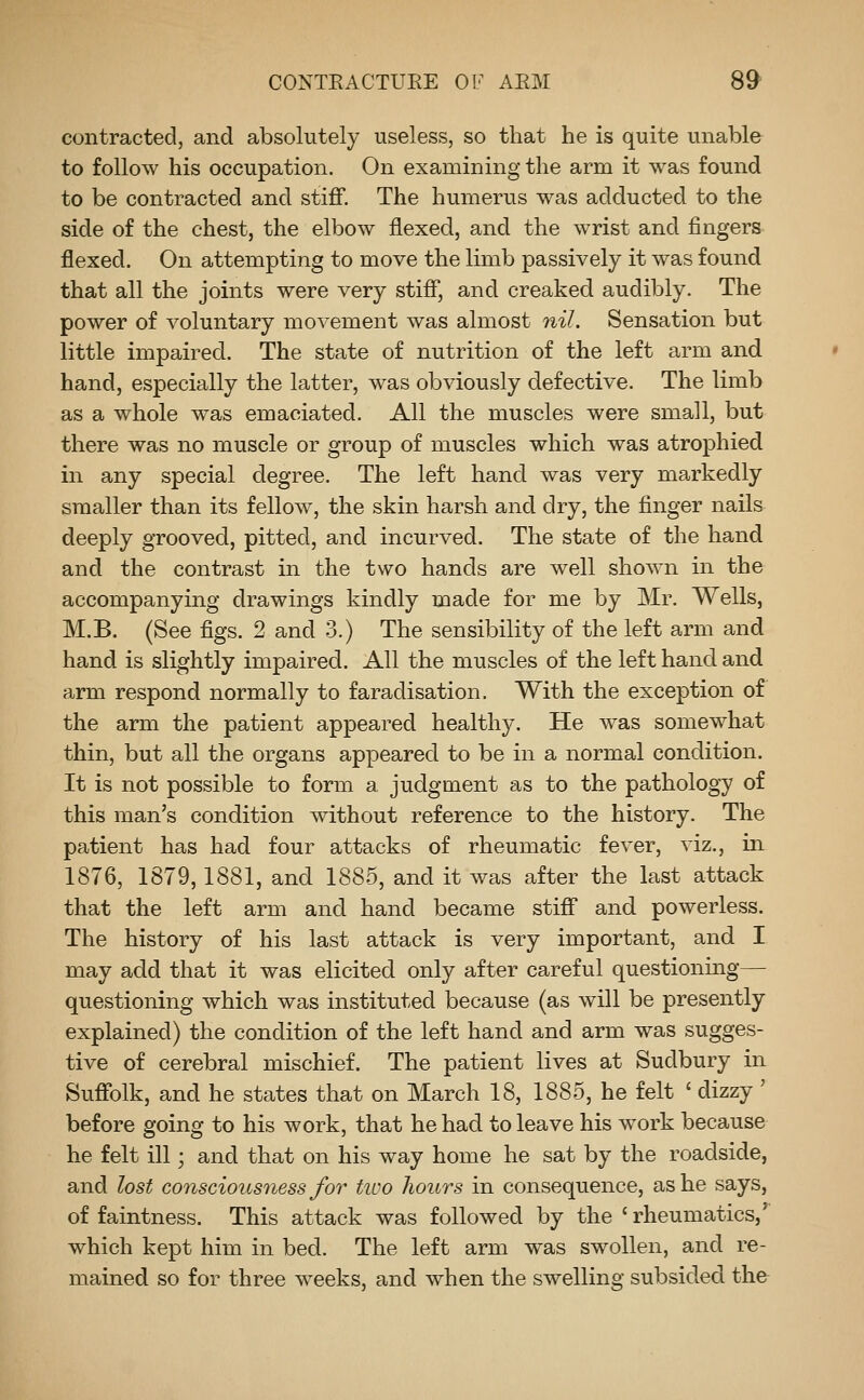 contracted, and absolutely useless, so that he is quite unable to follow his occupation. On examining the arm it was found to be contracted and stiff. The humerus was adducted to the side of the chest, the elbow flexed, and the wrist and fingers flexed. On attempting to move the limb passively it was found that all the joints were very stiff, and creaked audibly. The power of voluntary movement was almost nil. Sensation but little impaired. The state of nutrition of the left arm and hand, especially the latter, was obviously defective. The limb as a whole was emaciated. All the muscles were small, but there was no muscle or group of muscles which was atrophied in any special degree. The left hand was very markedly smaller than its fellow, the skin harsh and dry, the finger nails deeply grooved, pitted, and incurved. The state of the hand and the contrast in the two hands are well shown in the accompanying drawings kindly made for me by Mr. Wells, M.B. (See figs. 2 and 3.) The sensibility of the left arm and hand is slightly impaired. All the muscles of the left hand and arm respond normally to faradisation, With the exception of the arm the patient appeared healthy. He was somewhat thin, but all the organs appeared to be in a normal condition. It is not possible to form a judgment as to the pathology of this man's condition without reference to the history. The patient has had four attacks of rheumatic fever, viz., in 1876, 1879,1881, and 1885, and it was after the last attack that the left arm and hand became stiff and powerless. The history of his last attack is very important, and I may add that it was elicited only after careful questionmg— questioning which was instituted because (as will be presently explained) the condition of the left hand and arm was sugges- tive of cerebral mischief. The patient lives at Sudbury in Suffolk, and he states that on March 18, 1885, he felt ' dizzy ' before going to his work, that he had to leave his work because he felt ill; and that on his way home he sat by the roadside, and lost consciousness for tioo hours in consequence, as he says, of faintness. This attack was followed by the ' rheumatics,' which kept him in bed. The left arm was swollen, and re- mained so for three weeks, and when the swelling subsided the