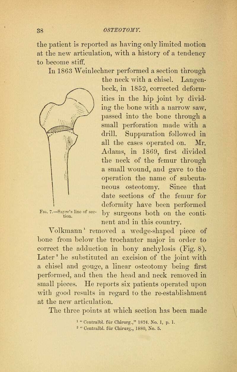 the patient is reported as having only limited motion at the new articulation, with a history of a tendency to become stiff. In 1863 Weinlechner performed a section through the neck with a chisel. Langen- beck, in 1852, corrected deform- ities in the hip joint by divid- ing the bone with a narrow saw, passed into the bone through a small perforation made with a drill. Suppuration followed in all the cases operated on. Mr. Adams, in 1869, first divided the neck of the femur through a small wound, and gave to the operation the name of subcuta- neous osteotomy. Since that date sections of the femur for deformity have been performed by surgeons both on the conti- nent and in this country. Volkmann1 removed a wedge-shaped piece of bone from below the trochanter major in order to correct the adduction in bony anchylosis (Fig. 8). Later2 he substituted an excision of the joint with a chisel and gouge, a linear osteotomy being first performed, and then the head and neck removed in small pieces. He reports six patients operated upon with good results in regard to the re-establishment at the new articulation. The three points at which section has been made 1  Centralbl. fur Chirurg., 1874. No. 1, p. 1. 2  Centralbl. fiir Chirurg., 1880, No. 5. Fig. 7.—Sayre's line of sec- tion.