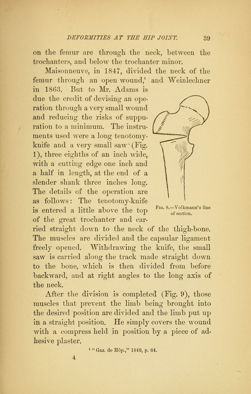 on the femur are through the neck, between the trochanters, and below the trochanter minor. Maisonneuve, in 1847, divided the neck of the femur through an open wound,1 and Weinlechner in 1863. But to Mr. Adams is due the credit of devising an ope- ration through a very small wound and reducing the risks of suppu- ration to a minimum. The instru- ments used were a long tenotomy- knife and a very small saw*(Fig. 1), three eighths of an inch wide, with a cutting edge one inch and a half in length, at the end of a slender shank three inches long. The details of the operation are as follows: The tenotomy-knife is entered a little above the top of the great trochanter and car- ried straight down to the neck of the thigh-bone. The muscles are divided and the capsular ligament freely opened. Withdrawing the knife, the small saw is carried along the track made straight down to the bone, which is then divided from before backward, and at right angles to the long axis of the neck. After the division is completed (Fig. 9), those muscles that prevent the limb being brought into the desired position are divided and the limb put up in a straight position. He simply covers the wound with a compress held in position by a piece of ad- hesive plaster. 1  Gaz. de Hop., 1849, p. 64. Fig. 8.—Volkmann's line