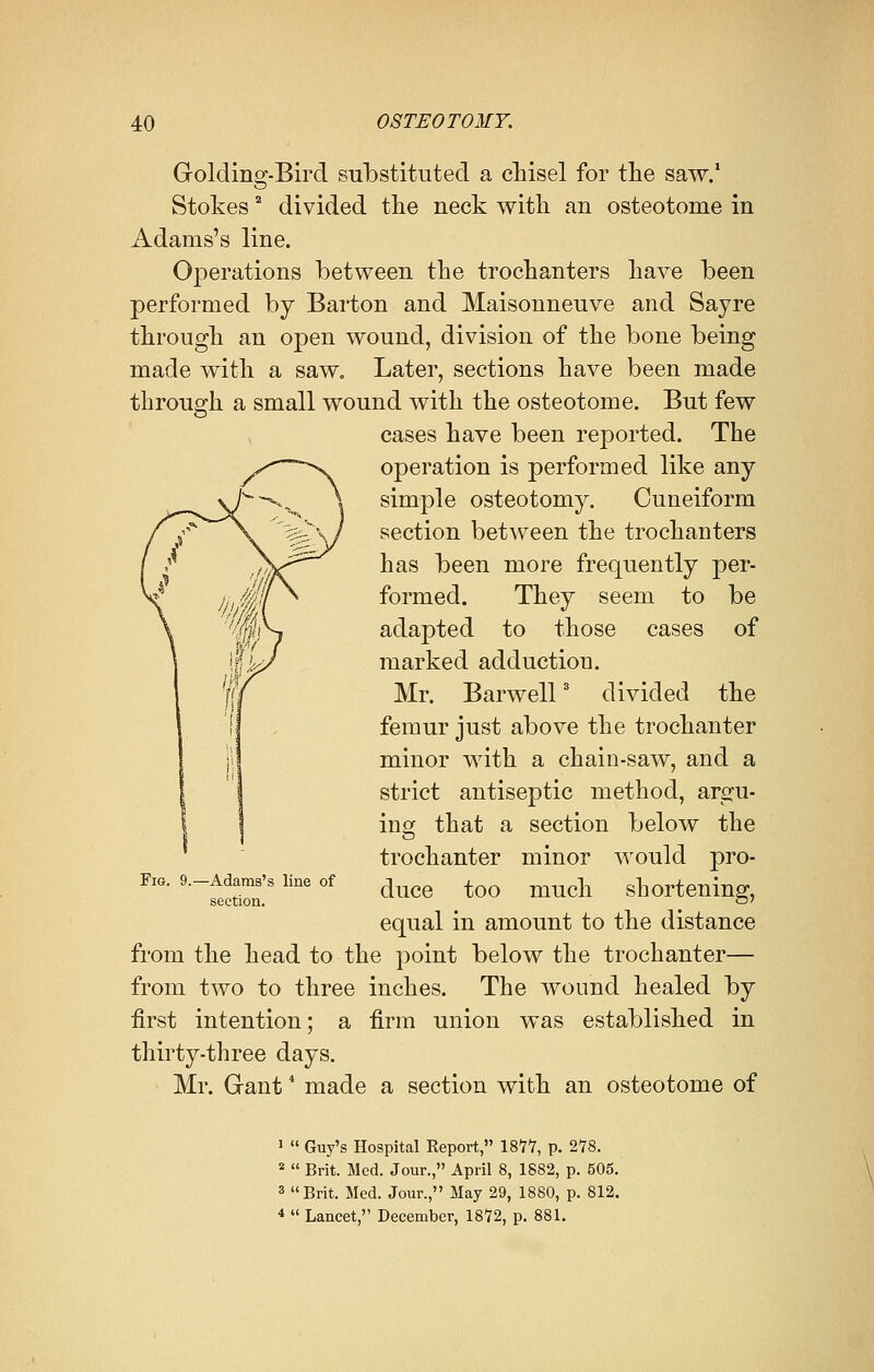 Goldino-.Bird substituted a chisel for the saw.1 Stokes2 divided the neck with an osteotome in Adams's line. Operations between the trochanters have been performed by Barton and Maisonneuve and Sayre through an open wound, division of the bone being made with a saw. Later, sections have been made through a small wound with the osteotome. But few cases have been reported. The operation is performed like any simple osteotomy. Cuneiform section between the trochanters has been more frequently per- formed. They seem to be adapted to those cases of marked adduction. Mr. Barwell3 divided the femur just above the trochanter minor with a chain-saw, and a strict antiseptic method, argu- ing that a section below the trochanter minor would pro- duce too much shortening, equal in amount to the distance from the head to the point below the trochanter— from two to three inches. The wound healed by first intention; a firm union was established in thirty-three days. Mr. Gant4 made a section with an osteotome of Fig. 9.—Adams's line of section. 1  Guy's Hospital Report, 187V, p. 278. 2  Brit. Med. Jour., April 8, 1882, p. 505. 3 Brit. Med. Jour., May 29, 1880, p. 812. 4  Lancet, December, 1872, p. 881.