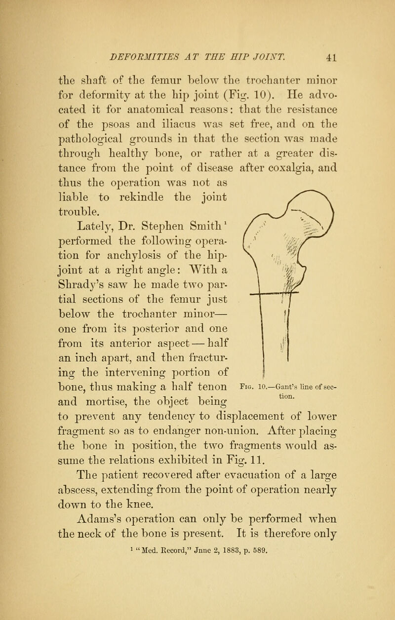 the shaft of the femur below the trochanter minor for deformity at the hip joint (Fig. 10). He advo- cated it for anatomical reasons: that the resistance of the psoas and iliacus was set free, and on the pathological grounds in that the section was made through healthy bone, or rather at a greater dis- tance from the point of disease after coxalgia, and thus the operation was not as liable to rekindle the joint trouble. Lately, Dr. Stephen Smith1 performed the following opera- tion for anchylosis of the hip- joint at a right angle: With a Shrady's saw he made two par- tial sections of the femur just below the trochanter minor— one from its posterior and one from its anterior aspect — half an inch apart, and then fractur- ing the intervening portion of bone, thus making a half tenon Fig. 10.—Gant'siineofsec- and mortise, the object being to prevent any tendency to displacement of lower fragment so as to endanger non-union. After placing the bone in position, the two fragments would as- sume the relations exhibited in Fig-. 11. The patient recovered after evacuation of a large abscess, extending from the point of operation nearly down to the knee. Adams's operation can only be performed when the neck of the bone is present. It is therefore only 1 Med. Record, Jnne 2, 1883, p. 589.