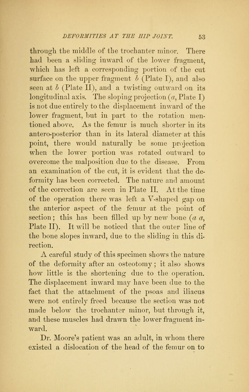 through the middle of the trochanter minor. There had been a sliding inward of the lower fragment, which has left a corresponding portion of the cut surface on the upper fragment b (Plate I), and also seen at b (Plate II), and a twisting outward on its longitudinal axis. The sloping projection (a, Plate I) is not due entirely to the displacement inward of the lower fragment, but in part to the rotation men- tioned above. As the femur is much shorter in its antero-posterior than in its lateral diameter at this point, there would naturally be some projection when the lower portion was rotated outward to overcome the malposition due to the disease. From an examination of the cut, it is evident that the de- formity has been corrected. The nature and amount of the correction are seen in Plate II. At the time of the operation there was left a V-shaped gap on the anterior aspect of the femur at the point of section; this has been filled up by new bone (a a, Plate II). It will be noticed that the outer line of the bone slopes inward, due to the sliding in this di- rection. A careful study of this specimen shows the nature of the deformity after an osteotomy; it also shows how little is the shortening due to the operation. The displacement inward may have been due to the fact that the attachment of the psoas and iliacus were not entirely freed because the section was not made below the trochanter minor, but through it, and these muscles had drawn the lower fragment in- ward. Dr. Moore's patient was an adult, in whom there existed a dislocation of the head of the femur on to