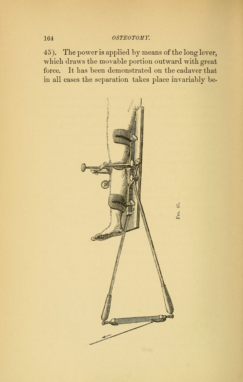 45). The power is applied by means of the long lever, which draws the movable portion outward with great force. It has been demonstrated on the cadaver that in all cases the separation takes place invariably be-