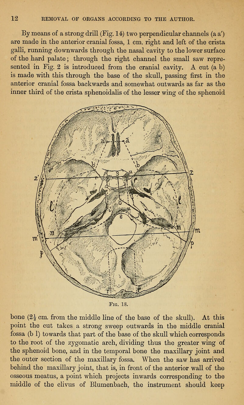 By means of a strong drill (Fig. 14) two perpendicular channels (a a') are made in the anterior cranial fossa, 1 cm. right and left of the crista galli, running downwards through the nasal cavity to the lower surface of the hard palate; through the right channel the small saw repre^ sented in Fig. 2 is introduced from the cranial cavity. A cut (a b) is made with this through the base of the skull, passing first in the anterior cranial fossa backwards and somewhat outwards as far as the inner third of the crista sphenoidalis of the lesser wing of the sphenoid Fig. 18. bone (2| cm. from the middle line of the base of the skull). At this point the cut takes a strong sweep outwards in the middle cranial fossa (b 1) towards that part of the base of the skull which corresponds to the root of the zygomatic arch, dividing thus the greater wing of the sphenoid bone, and in the temporal bone the maxillary joint and the outer section of the maxillary fossa. When the saw has arrived behind the maxillary joint, that is, in front of the anterior wall of the osseous meatus, a point which projects inwards corresponding to the middle of the clivus of Blumenbach, the instrument should keep