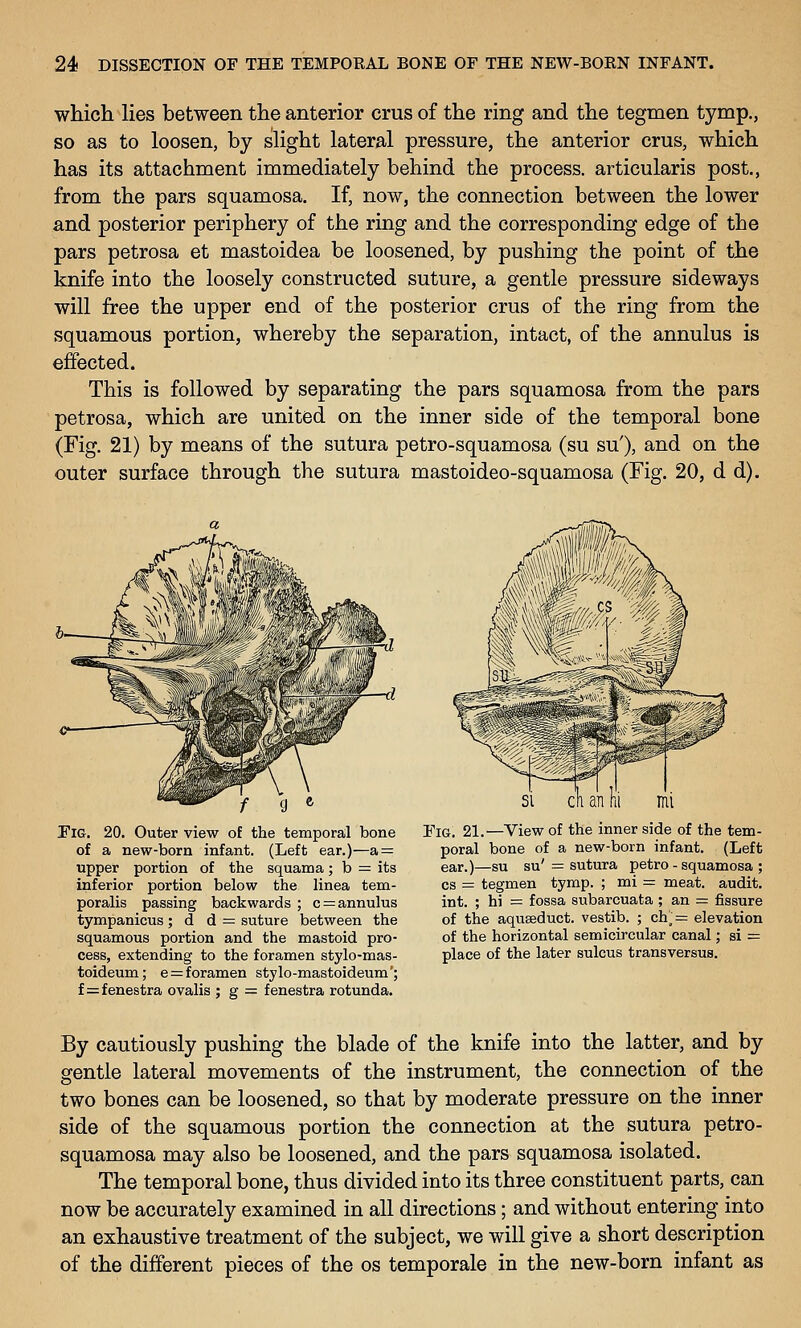 which Hes between the anterior crus of the ring and the tegmen tymp., so as to loosen, by shght lateral pressure, the anterior crus, which has its attachment immediately behind the process, articularis post., from the pars squamosa. If, now, the connection between the lower and posterior periphery of the ring and the corresponding edge of the pars petrosa et mastoidea be loosened, by pushing the point of the knife into the loosely constructed suture, a gentle pressure sideways will free the upper end of the posterior crus of the ring from the squamous portion, whereby the separation, intact, of the annulus is effected. This is followed by separating the pars squamosa from the pars petrosa, which are united on the inner side of the temporal bone (Fig. 21) by means of the sutura petro-squamosa (su su'), and on the outer surface through the sutura mastoideo-squamosa (Fig. 20, d d). Pig. 20. Outer view of the temporal bone of a new-born infant. (Left ear.)—a = upper portion of the squama; b = its inferior portion below the linea tem- poralis passing backwards ; c = annulus tympanicus; d d = suture between the squamous portion and the mastoid pro- cess, extending to the foramen stylo-mas- toideum; e = foramen stylo-mastoideum'; f=fenestra ovalis ; g = fenestra rotunda. Fig. 21.—View of the inner side of the tem- poral bone of a new-born infant. (Left ear.)—su su'= sutura petro-squamosa; cs = tegmen tymp. ; mi = meat, audit, int. ; hi = fossa subarcuata ; an = fissure of the aquseduct. vestib. ; ch_=: elevation of the horizontal semicircular canal; si = place of the later sulcus transversus. By cautiously pushing the blade of the knife into the latter, and by gentle lateral movements of the instrument, the connection of the two bones can be loosened, so that by moderate pressure on the inner side of the squamous portion the connection at the sutura petro- squamosa may also be loosened, and the pars squamosa isolated. The temporal bone, thus divided into its three constituent parts, can now be accurately examined in all directions; and without entering into an exhaustive treatment of the subject, we will give a short description of the different pieces of the os temporale in the new-born infant as