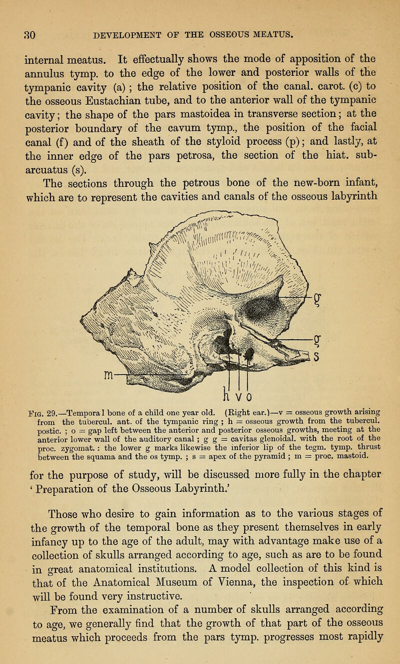 internal meatus. It effectually shows the mode of apposition of the annulus tymp. to the edge of the lower and posterior walls of the tympanic cavity (a); the relative position of the canal, carot. (c) to the osseous Eustachian tube, and to the anterior wall of the tympanic cavity; the shape of the pars mastoidea in transverse section; at the posterior boundary of the cavum tymp., the position of the facial canal (f) and of the sheath of the styloid process (p); and lastly, at the inner edge of the pars petrosa, the section of the hiat. sub- arcuatus (s). The sections through the petrous bone of the new-born infant, which are to represent the cavities and canals of the osseous labyrinth Fig. 29.—Temporal bone of a child one year old. (Right ear.)—v = osseous growth arising from the tubercul. ant. of the tjrmpanic ring ; h = osseous growth from the tubercul, postic. ; o — gap left between the anterior and posterior osseous growths, meeting at the anterior lower wall of the auditory canal; g g = cavitas glenoidal. with the root of the proc. zygomat. : the lower g marks likewise the inferior lip of the tegm. tymp. thrust between the squama and the os tymp. ; s = apex of the pyramid ; m = proc. mastoid. for the purpose of study, will be discussed more fully in the chapter ' Preparation of the Osseous Labyrinth.' Those who desire to gain information as to the various stages of the growth of the temporal bone as they present themselves in early infancy up to the age of the adult, may with advantage make use of a collection of skulls arranged according to age, such as are to be found in great anatomical institutions. A model collection of this kind is that of the Anatomical Museum of Vienna, the inspection of which will be found very instructive. From the examination of a number of skulls arranged according to age, we generally find that the growth of that part of the osseous meatus which proceeds from the pars tymp. progresses most rapidly