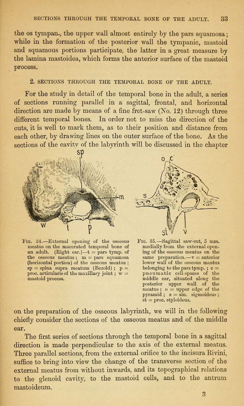 the OS tympan., the upper wall almost entirely by the pars squamosa; while in the formation of the posterior wall the tympanic, mastoid and squamous portions participate, the latter in a great measure by the lamina mastoidea, which forms the anterior surface of the mastoid process. 2. SECTIONS THROUGH THE TEMPORAL BONE OF THE ADULT. For the study in detail of the temporal bone in the adult, a series of sections running parallel in a sagittal, frontal, and horizontal direction are made by means of a fine fret-saw (No. 12) through three different temporal bones. In order not to miss the direction of the cuts, it is well to mark them, as to their position and distance from each other, by drawing lines on the outer surface of the bone. As the sections of the cavitv of the labyrinth will be discussed in the chapter 'sp ' '/I Fig. 34.—External opening of the osseous meatus on the macerated temporal bone of an adult. (Right ear.)—t = pars tymp. of the osseous meatus ; m = pars squamosa (horizontal portion) of the osseous meatus ; sp = spina supra meatum (Bezold) ; p =: proc. articularis of the maxillary joint ; w = mastoid process. Fig. 35.—Sagittal saw-cut, 5 mm. medially from the external open- ing of the osseous meatus on the same preparation.—v = anterior lower wall of the osseous meatus belonging to the pars tymp, ; c =: pneumatic cell-spaces of the middle ear, situated along the posterior upper wall of the meatus ; o = upper edge of the pyramid ; s — sin. sigmoideus ; st = proc. styloideus. on the preparation of the osseous labyrinth, we will in the following chiefly consider the sections of the osseous meatus and of the middle ear. The first series of sections through the temporal bone in a sagittal direction is made perpendicular to the axis of the external meatus. Three parallel sections, from the external orifice to the incisura Rivini, suffice to bring into view the change of the transverse section of the external meatus from without inwards, and its topographical relations to the glenoid cavity, to the mastoid cells, and to the antrum mastoideum. 3