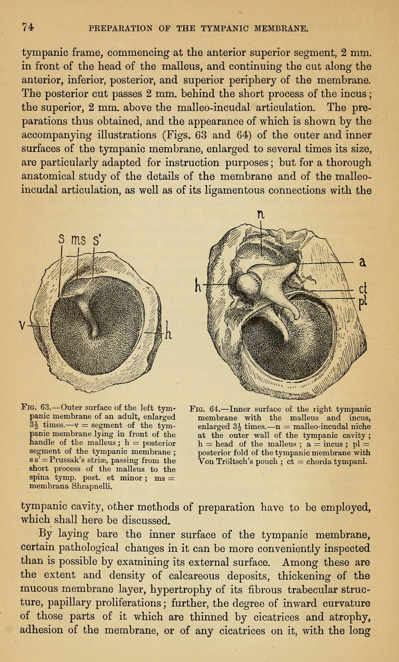 V4 tympanic frame, comm.encing at tlie anterior superior segment, 2 mm. in front of the head of the malleus, and continuing the cut along the anterior, inferior, posterior, and superior periphery of the membrane. The posterior cut passes 2 mm. behind the short process of the incus; the superior, 2 mm. above the malleo-incudal articulation. The pre- parations thus obtained, and the appearance of which is shown by the accompanying illustrations (Figs. 63 and 64) of the outer and inner surfaces of the tympanic membrane, enlarged to several times its size, are particularly adapted for instruction purposes; but for a thorough anatomical study of the details of the membrane and of the malleo- incudal articulation, as well as of its ligamentous connections with the Fig. 63.—Outer surface of the left tym- panic membrane of an adult, enlarged 3J times,—v = segment of the tym- panic membrane lying in front of the handle of the malleus; h = posterior segment of the tympanic membrane ; s s' = Prussak's striae, passing from the short process of the malleus to the spina tymp. post, et minor; ms = membrana Shrapnelli. Fig. 64.—Inner surface of the right tympanic membrane with the malleus and incus, enlarged 3J times.—n — malleo-incudal niche at the outer wall of the tympanic cavity ; h — head of the malleus ; a = incus ; pi = posterior fold of the tympanic membrane with Von Troltsch's pouch ; ct = chorda tympani. tympanic cavity, other methods of preparation have to be employed, which shall here be discussed. By laying bare the inner surface of the tympanic membrane, certain pathological changes in it can be more conveniently inspected than is possible by examining its external surface. Among these are the extent and density of calcareous deposits, thickening of the mucous membrane layer, hypertrophy of its fibrous trabecular struc- ture, papillary proliferations; further, the degree of inward curvature of those parts of it which are thinned by cicatrices and atrophy, adhesion of the membrane, or of any cicatrices on it, with the long