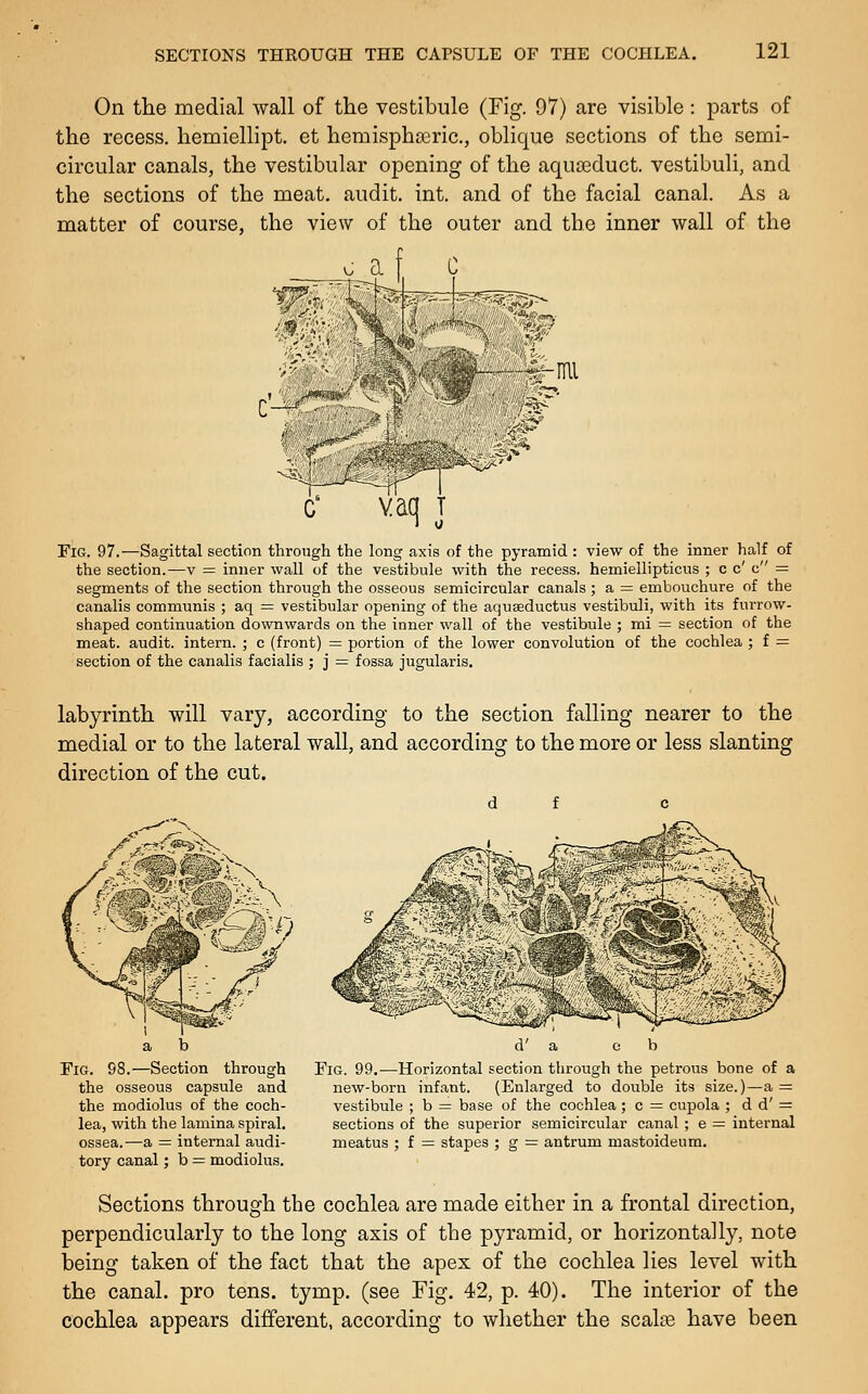 On the medial wall of the vestibule (Fig. 97) are visible : parts of the recess, hemiellipt. et hemisphEcric, oblique sections of the semi- circular canals, the vestibular opening of the aquceduct. vestibuli, and the sections of the meat, audit, int. and of the facial canal. As a matter of course, the view of the outer and the inner wall of the v; a f C vaq J Fig. 97.—Sagittal section through the long axis of the pyramid : view of the inner half of the section.—v = inner wall of the vestibule with the recess, hemiellipticus ; c c' c = segments of the section through the osseous semicircular canals ; a = embouchure of the canalis communis ; aq = vestibular opening of the aquseductus vestibuli, with its furrow- shaped continuation downwards on the inner wall of the vestibule ; mi = section of the meat, audit, intern. ; c (front) = portion of the lower convolution of the cochlea ; f — section of the canalis facialis ; j = fossa jugularis. labyrinth will vary, according to the section falling nearer to the medial or to the lateral wall, and according to the more or less slanting direction of the cut. d f c Fig. 98.—Section through the osseous capsule and the modiolus of the coch- lea, with the lamina spiral, ossea.—a = internal audi- tory canal; b = modiolus. Fig. 99.—Horizontal section through the petrous bone of a new-born infant. (Enlarged to double its size.)—a = vestibule ; b = base of the cochlea; c = cupola ; d d' = sections of the superior semicircular canal ; e = internal meatus ; f = stapes ; g = antrum mastoideum. Sections through the cochlea are made either in a frontal direction, perpendicularly to the long axis of the pyramid, or horizontally, note being taken of the fact that the apex of the cochlea lies level with the canal, pro tens. tymp. (see Fig. 42, p. 40). The interior of the cochlea appears different, according to whether the scalte have been