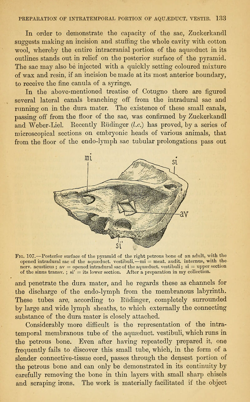 In order to demonstrate the capacity of the sac, Zuckerkandl suggests making an incision and stuffing the whole cavity with cotton wool, whereby the entire intracranial portion of the aqua3duct in its outlines stands out in relief on the posterior surface of the pyramid. The sac may also be injected with a quickly setting coloured mixture of wax and resin, if an incision be made at its most anterior boundary, to receive the fine canula of a sj^inge. In the above-mentioned treatise of Cotugno there are figured several lateral canals branching off from the intradural sac and runninef on in the dura mater. The existence of these small canals, passing off from the floor of the sac, was confirmed by Zuckerkandl and Weber-Liel. Recently Rlidinger (Lc.) has proved, by a series of microscopical sections on embryonic heads of various animals, that from the floor of the endo-lymph sac tubular prolongations pass out Fig. 107.—Posterior surface of the pyramid of the right petrous bone of an adult, with the opened intradural sac of the aquseduct. vestibuli.—mi = meat, audit, internus, with the nerv. acusticus ; av =: opened intradural sac of the aquseduct. vestibuli; si = upper section of the sinus transv. ; si' = its lower section. After a preparation in my collection. and penetrate the dura mater, and he regards these as channels for the discharge of the endo-lymph from the membranous labyrinth. These tubes are, according to Eildinger, completely surrounded by large and wide lymph sheaths, to which externally the connecting substance of the dura mater is closely attached. Considerably more difficult is the representation of the intra- temporal membranous tube of the aquseduct. vestibuli, which runs in the petrous bone. Even after having repeatedly prepared it, one frequently fails to discover this small tube, which, in the form of a slender connective-tissue cord, passes through the densest portion of the petrous bone and can only be demonstrated in its continuity by carefully removing the bone in thin layers with small sharp chisels and scraping irons. The work is materially facilitated if the object