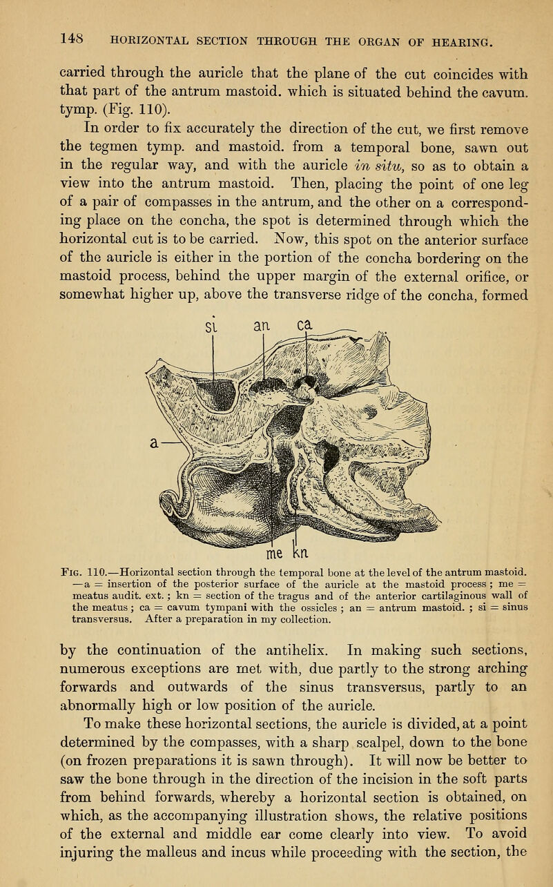 carried through the auricle that the plane of the cut coincides with that part of the antrum mastoid, which is situated behind the cavum. tymp. (Fig. 110). In order to fix accurately the direction of the cut, we first remove the tegmen tymp. and mastoid, from a temporal bone, sawn out in the regular way, and with the auricle in situ, so as to obtain a view into the antrum mastoid. Then, placing the point of one leg of a pair of compasses in the antrum, and the other on a correspond- ing place on the concha, the spot is determined through which the horizontal cut is to be carried. Now, this spot on the anterior surface of the auricle is either in the portion of the concha bordering on the mastoid process, behind the upper margin of the external orifice, or somewhat higher up, above the transverse ridge of the concha, formed Fig. 110.—Horizontal section through the temporal bone at the level of the antrum mastoid. —a = insertion of the posterior surface of the auricle at the mastoid process ; me = meatus audit, ext.; kn = section of the tragus and of the anterior cartilaginous wall of the meatus; ca = cavum tympani with the ossicles ; an = antrum mastoid. ; si = sinus transversus. After a preparation in my collection. by the continuation of the antihelix. In making such sections, numerous exceptions are met with, due partly to the strong arching forwards and outwards of the sinus transversus, partly to an abnormally high or low position of the auricle. To make these horizontal sections, the auricle is divided, at a point determined by the compasses, with a sharp scalpel, down to the bone (on frozen preparations it is sawn through). It will now be better to saw the bone through in the direction of the incision in the soft parts from behind forwards, whereby a horizontal section is obtained, on which, as the accompanying illustration shows, the relative positions of the external and middle ear come clearly into view. To avoid injuring the malleus and incus while proceeding with the section, the