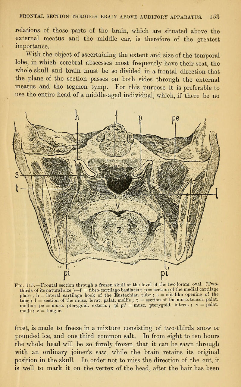 relations of those parts of the brain, which are situated above the external meatus and the middle ear, is therefore of the greatest importance. With the object of ascertaining the extent and size of the temporal lobe, in which cerebral abscesses most frequently have their seat, the whole skull and brain must be so divided in a frontal direction that the plane of the section passes on both sides through the external meatus and the tegmen tymp. For this purpose it is preferable to use the entire head of a middle-aged individual, which, if there be no Fig. 115.—Frontal section through a frozen skull at the level of the twoforam. oval. (Two- thirds of its natural size.)—f = fibro-cartilago basilaris ; p = section of the medial cartilage plate ; h = lateral cartilage hook of the Eustachian tube ; s = slit-like opening of the tube ; 1 = section of the muse, levat. palat. mollis ; t = section of the muse, tensor, palat. mollis ; pe = muse, pterygoid, extern.; pi pi' = muse, pterygoid, intern. ; v = palat. moUe ; z = tongue. frost, is made to freeze in a mixture consisting of two-thirds snow or pounded ice, and one-third common salt. In from eight to ten hours the whole head will be so firmly frozen that it can be sawn through with an ordinary joiner's saw, while the brain retains its original position in the skull. In order not to miss the direction of the cut, it is well to mark it on the vertex of the head, after the hair has been