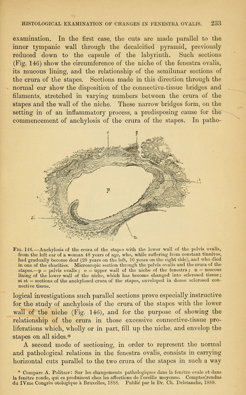 examination. In the first case, the cuts are made parallel to the inner tympanic wall through the decalcified pyramid, previously reduced down to the capsule of the labyrinth. Such sections (Fig. 146) show the circumference of the niche of the fenestra ovalis, its mucous lining, and the relationship of the semilunar sections of the crura of the stapes. Sections made in this direction through the normal ear show the disposition of the connective-tissue bridges and filaments, stretched in varying numbers between the crura of the stapes and the wall of the niche. These narrow bridges form, on the setting in of an inflammatory process, a predisposing cause for the commencement of anchylosis of the crura of the stapes. In patho- Fig. 146.—Anchylosis of the crura of the stapes with the lower wall of the pelvis_ ovalis, from the left ear of a woman 48 years of age, who, while suffering from constant tinnitus, had gradually become deaf (20 years on the left, 10 years on the right side), and who died in one of the charities. Microscopic section through the pelvis ovalis and the crura of the stapes.—p = pelvis ovalis ; o = upper wall of the niche of the fenestra ; n = mucous lining of the lower wall of the niche, which has become changed into sclerosed tissue ; St st = sections of the anchylosed crura of the stapes, enveloped in dense sclerosed con- nective tissue. logical investigations such parallel sections prove especially instructive for the study of anchylosis of the crura of the stapes with the lower wall of the niche (Fig. 146), and for the purpose of showing the relationship of the crura in those excessive connective-tissue pro- liferations which, wholly or in part, fill up the niche, and envelop the stapes on all sides.* A second mode of sectioning, in order to represent the normal and pathological relations in the fenestra ovalis, consists in carrying horizontal cuts parallel to the two crura of the stapes in such a way * Compare A. Politzer: Sur les changements pathologiques dans la fent'tre ovale et dans la fenetre ronde, qui es produisent chez les affections de I'oreille moyenne. Comptes'rendus du IVme Congrfes otologique a Bruxelles, 1S8S. Publie par le Dr. Ch. Delstanclie, 1SS9.