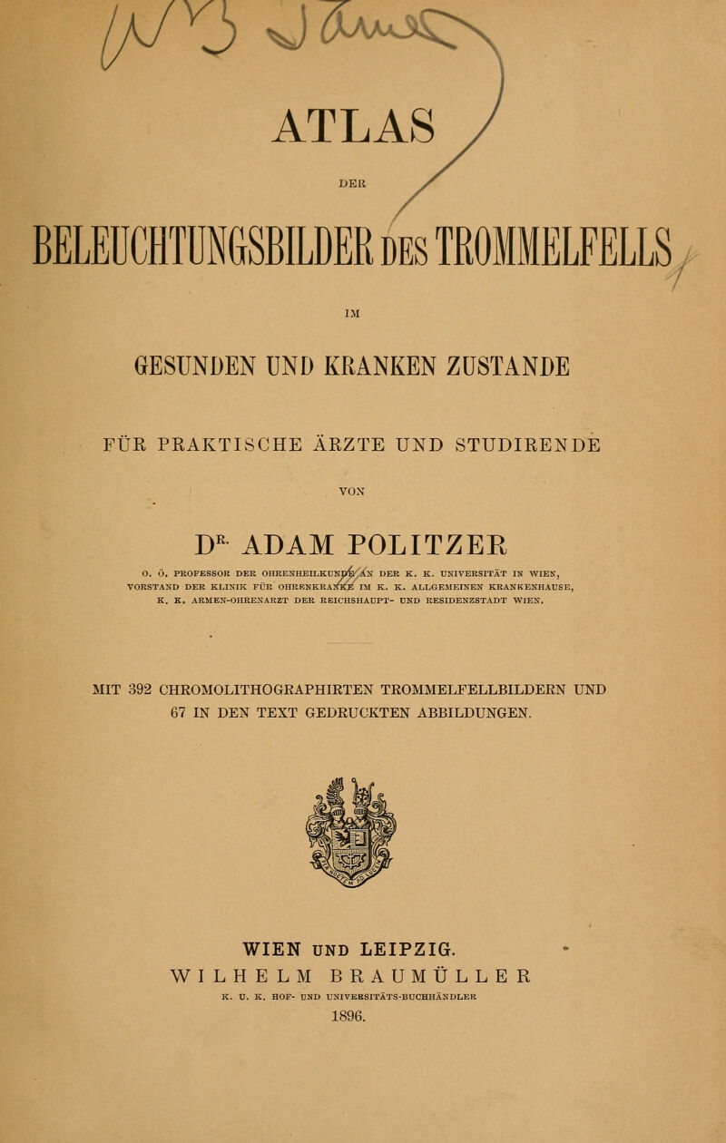 oo ATLAS DER BELEÜCHTÜNGSBILDER des TROMMELFELLS IM GESUNDEN UND KRANKEN ZUSTANDE FÜR PRAKTISCHE ÄRZTE UND STUDIRENDE VON D ADAM POLITZER O. Ö. PROFESSOR DER OHRENHEILKDNl/p^AN DER K. K. UNIVERSITÄT IN WIEN, VORSTAND DER KLINIK FÜR OHRENKRAimB IM K. K. ALLGEMEINEN KRANKENHAÜSB, K. E. ARMEN-OHRENARZT DER RBICHSHAÜPT- UND RESIDENZSTADT WIEN. MIT 392 CHROMOLITHOGKAPHIRTEN TROMMELFELLBILDERN UND 67 IN DEN TEXT GEDRUCKTEN ABBILDUNGEN. WIEN UND LEIPZIG. WILHELM BRAUMÜLLER K. ü. K. HOF- DND UNIVERSITÄTS-BUCHHÄNDLER 1896.