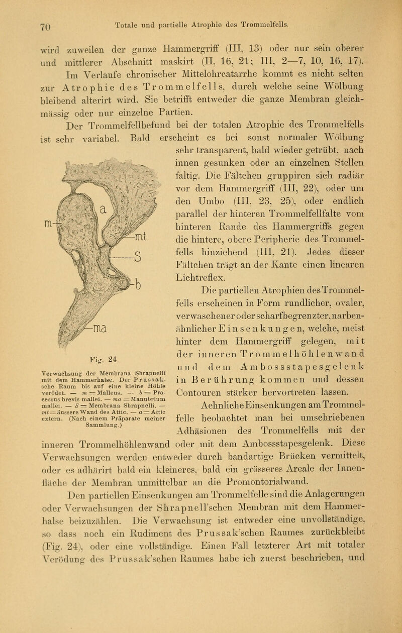 :^ wird zuweilen der ganze Hammergriff (III, 13) oder nur sein oberer und mittlerer Abschnitt maskirt (IL 16, 21; III, 2—7, 10, 16, 17). Im Verlaufe cbronisclier Mittelohrcatarrhe kommt es nicbt selten zur Atrophie des Trommelfells, durch welche seine Wölbung bleibend alterirt Avird. Sie betrifft entweder die ganze Membran gleich- massig oder nur einzelne Partien. Der Trommelfellbefund bei der totalen Atrophie des Trommelfells ist sehr variabel. Bald erscheint es bei sonst normaler Wölbung sehr transparent, bald wieder getrübt, nach innen gesunken oder an einzelnen Stellen faltig. Die Fältchen gruppiren sich radiär vor dem Hammergriff (III, 22), oder um den Umbo (III. 23, 25), oder endhch parallel der hinteren Trommelfellfalte vom hinteren Rande des Hammergriffs gegen die hintere, obere Peripherie des Trommel- fells hinziehend (III, 21). Jedes dieser Fältchen trägt an der Kante einen linearen Lichtreflex. Die partiellen Atrophien des Trommel- fells erscheinen in Form rundlicher, ovaler, verwaschener oder scharf begrenzter, narben- ähnlicher Einsenkungen, welche, meist hinter dem Hammergriff gelegen, mit der inneren Tr o mm elh ö hl en wan d und dem A m b o s s s t a p e s g e 1 e n k in Berührung kommen und dessen Contouren stärker hervortreten lassen. Aehnliche Einsenkun gen am Trommel- felle beobachtet man bei umschriebenen Adhäsionen des Trommelfells mit der inneren Trommelhöhlenwand oder mit dem Ambossstapesgelenk. Diese Verwachsungen werden entweder durch bandartige Brücken vermittelt, oder es adhärirt bald ein kleineres, bald ein grösseres Areale der Innen- fläche der Membran unmittelbar an die Promontorialwand. Den partiellen Einsenkungen am Trommelfelle sind die Anlagerungen oder Verwachsungen der SbrapnelTschcn Membran mit dem Hammer- halse beizuzählen. Die Verwachsung ist entweder eine unvollständige, so dass noch ein Rudiment des Prussak'schen Raumes zurückbleibt (Fig. 24), oder eine vollständige. Einen Fall letzterer Art mit totaler Veröduno- des l^russak'schen Raumes habe ich zuerst beschrieben, und Fig. 24. Verwachsung der Membrana Shrapnelli mit dem Hammerhalse. Der Prusaak- sche Raum bis auf eine kleine Höhle verödet. — m = Malleus. — & = Pro- cessus brevis mallei. — ma =Manubrium mallei. — 6'■= Membrana Shrapnelli. — 7»« = äussere Wand des Attic. — a = Attie extern. (Nach einem Präparate meiner Sammlung.)