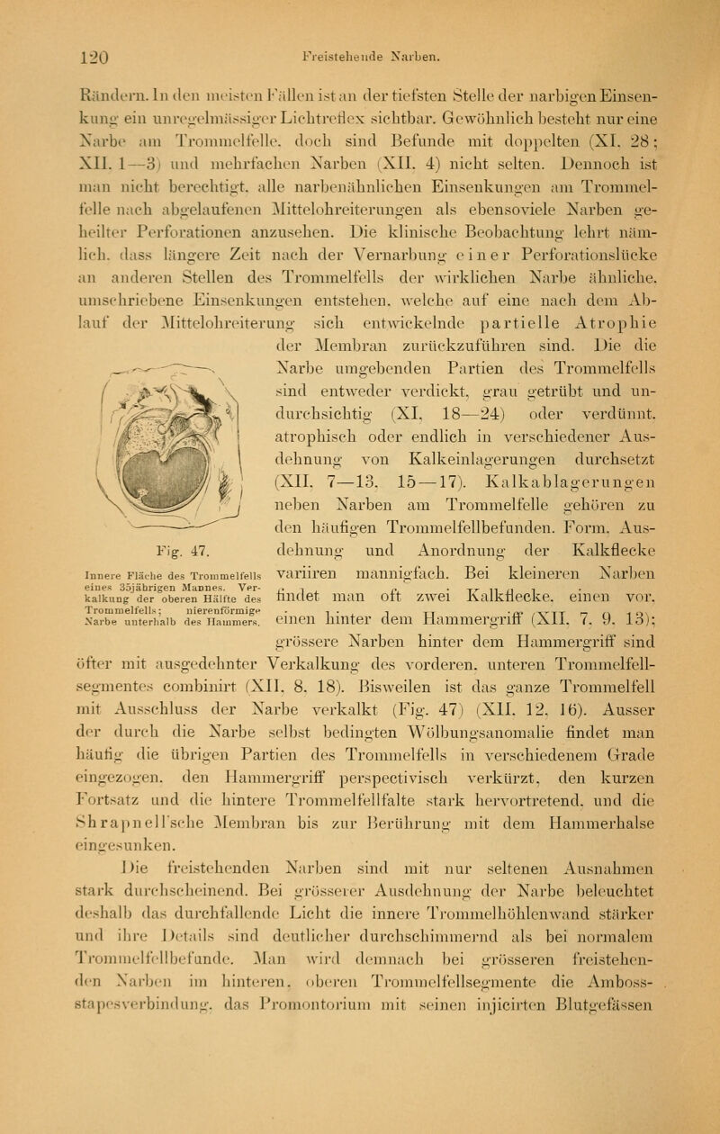Räntk'i'u. Intlen iiK'istcn Fällen ist an der tiefsten Stelleder narbigen Einsen- kung- ein unregelmässiger Liehtreticx sichtbar. Gewöhnlich bestellt nur eine Xarbe am 'rronimelfelle. doch sind Befunde mit doppelten (XI. 28; XII. 1—3) und mehrfachen Xarben [XII. 4) nicht selten. Dennoch ist man nicht berechtigt, alle narbenähnlichen Einseukungen am Trommel- felle nach abgelaufenen ]\Iittelohreiterungen als ebensoviele Narben ge- heilter Perforationen anzusehen. Uie klinische Beobachtung lehrt näm- lich, dass längere Zeit nach der Vernarbung e i n e r Perforationslücke an anderen Stellen des Trommelfells der A\drklichen Xarbe ähnliche. umschriebene Einsenkungen entstehen. Avelche auf eine nach dem Al)- lauf der ]\Iittelohreiterung sich entwickelnde partielle Atrophie der Membran zurückzuführen sind. Die die Xarbe umgebenden Partien des Trommelfells sind entweder verdickt, grau getrübt und un- durchsichtig (XI, 18—24) oder verdünnt, atrophisch oder endlich in verschiedener Aus- dehnung von Kalkeinlagerungen durchsetzt (XII. 7—13. 15 — 17). Kalkablagerungen neben Xarben am Trommelfelle gehören zu den häufigen Trommelfellbefanden. P^orm. Aus- dehnung und Anordnung der Kalkflecke variiren mannigfach. Bei kleineren Xarben findet man oft zwei Kalkflecke, einen vor. einen hinter dem Hammergriff (XII. 7. 9. 13): grössere Xarben hinter dem Hammergriff sind öfter mit ausgedehnter Verkalkung des vorderen, unteren Trommelfell- segmentes combinirt fXII. 8. 18). Bisweilen ist das ganze Trommelfell mit Ausschluss der Xarbe verkalkt (Fig. 47) (XII. 12. 16). Ausser der durch die Xarbe selbst bedingten Wölbungsanomalie findet man häufig die übrigen Partien des Trommelfells in verschiedenem Grade eingezogen, den Hammergriff perspectivisch verkürzt, den kurzen Fortsatz und die hintere Trommel feil falte stark hervortretend, und die Sbrapnellsche Membran bis zur Berührung mit dem Hammerhalse eingesunken. Die freistehenden Xarben sind mit nur seltenen Ausnahmen stark durchscheinend. Bei gi'össeier Ausdehnung der Xarbe beleuchtet deshalb das durchfallende Licht die innere Trommelhöhlenwand stärker und ihre Details sind deutliche)- dui'chschimmej'nd als bei normalem Trommelfi-Ubefande. Man Avird demnach bei grösseren freistehen- den Xarben im hinteren, oberen Trojnmelfellsegmente die Amboss- stapesverbindung. das Promontoi-ium mit seinen injicirten Blutgefässen Fig. 47. Innere Fläclie des Trommelfells eines äöjährigen Mannes. Ver- kalkung der oberen Hälfte des Trommelfells; nierenförmige Xarbe unterhalb des Hammers.