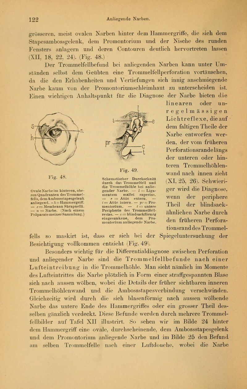 gTüsseren. meist ovalen Narben hinter dem Hammergriffe, die sicli dem Stapesambossgelenk. dem Promontorium und der Nische des runden Fensters anlagern und deren Contouren deutlich hervortreten lassen (XII. 18. 22. 241 (Fig. 48.) Der Trommelfellbefund bei anliegenden Narben kann unter Um- ständen selbst dem Geübten eine Trommelfellperforation vortäuschen, da die den Erhabenheiten und Vertiefungen sich innig anschmiegende Narbe kaum von der Promontoriumschleimhaut zu unterscheiden ist. Einen wichtigen Anhaltspunkt für die Diagnose der Narbe bieten die linearen oder un- regelmässigen Lichtreflexe, die auf • dem faltigen Theile der Narbe entworfen wer- den, der vom früheren Perforationsrande längs der unteren oder hin- teren Trommelhöhlen- wand nach innen zieht (XI. 25. 26). Schwieri- ger wird die Diagnose, wenn der periphere Theil der blindsack- ähnlichen Narbe durch den früheren Perfora- tionsrand des Trommel- fells so maskirt ist, dass er sich ]jei der Spiegeluntersuchung' der Besichtigung vollkommen entzieht (Fig. 49). Besonders wichtig für die Ditferentialdiagnose zwischen Perforation und anliegender Narbe sind die Trommelfellbefunde nach einer Lufteintreibung in die Trommelhöhle. Man sieht nämlich im Momente des Lufteintrittes die Narbe plötzlich in Form einer straffgespannten Blase sich nach aussen wölben, wobei die Details der früher sichtbaren inneren Trommelhöhlenwand und die Ambossstapesverbindung verschwinden. Gleichzeitig wird durch die sich blasenförmig- nach aussen wölbende Narbe das untere Ende des Hammergiüffes oder ein grosser Theil des- selben gänzlich verdeckt. Diese Befunde werden durch mehrere Trommel- fellbilder auf Tafel XII illustrirt. So sehen wir im Bilde 24 hinter dem Hammergriff eine; ovale, durchscheinende, dem Ambossstapesgelenk und dem Promontorium anliegende Narbe und im Bilde 25 den Befund, am selben Trommelfelle nach einer Luftdouche, wol)ei die Narbe Fis. 48. Ovale Xarbe im hinteren, obe- ren Quadranten des Trommel- fells, dem Ambossstapesgelenk anliegend. -7i = Hammergriff. — s= Jlembrana Shrapnelli. — n = Narbe. (Nach einem Präparate meiner .Sammlung.) Fig. 49. Schematiscber Durchschnitt durch das Trommelfell und die Trommelhöhle bei anlie- gender .Varbe. — l = Liga- mentum mallei superius. — e = Attic extern. — 7= Atiic intern. — ^)-= Pro- montorium. — t = untere Peripherie des Trommelfell- restes. — c = blindsackförmig eingesunkene, dem Pro- montorium anliegende Narbe.