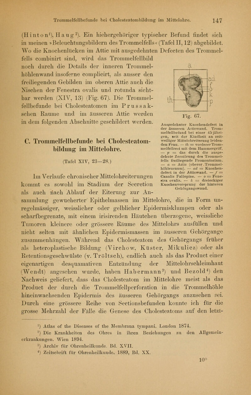 (Hinton'), Ha ug'-). Ein hieliergeliüriger typischer Befand findet sich in meinen »Belcuchtnngsbildern des Trommelfells« (Tafel II, 12) abg'ebildet. Wo die Knochenlücken im Attic mit ausgedehnten Defecten des Trommel- fells combinirt sind, wird das Trommelfellbild noch durch die Details der inneren Trommel- höhlenwand insoferne complicirt, als ausser den freiliegenden Gebilden im oberen Attic auch die Nischen der Fenestra ovalis und rotunda sicht- bar werden (XIV, 13) (Fig. 67). Die Trommel- fellbefunde bei Cholesteatomen im P r u s s a lo- schen Räume und im äusseren Attic werden in dem folgenden Abschnitte a'eschildert werden. Fig. 67. Ausgedehnter Knochendefect in der äusseren Aiticwand. Trom- melfellbet'und bei einer 45 jähri- gen, seit der Kindheit an zeit- weiliger Mittelohreiterung leiden- den frau. — th ■= vordererTroin- melfellrest mit dem Hammergriff. — p = das durch die ausge- dehnte Zerstörung des Trommel- fells freiliegende Promontorium. —■ a = Attic (oberer .Trommel- höhlenrauni). — ad = Knochen- defect in der Atticwand. — / = Canalis Fallopiae. — o = Fene- stra ovalis. — Ä: = dreieckiger Knochenvorsprung der hinteren Gehörgangswand. C. Trommelfellbefunde bei Cliolesteatom- bildiiiig im Mittelolire. (Tafel XIV, 23—28.) Im Verlaufe chronischer Mittelohreiterungen kommt es sowohl im Stadium der Secretion als auch nach Ablauf der Eiterung zur An- sammlung gewucherter' Epithelmassen im Mittelohre, die in Form un- regelmässiger, weisslicher oder gelblicher Epidermisklumpen oder als scharfbegrenzte, mit einem irisirenden Häutchen überzogene, weissliche Tumoren kleinere oder grössere Räume des Mittelohrs ausfüllen und nicht selten mit ähnlichen Epidermismassen im äusseren Gehörgange zusammenhängen. Während das Cholesteatom des Gehörgangs früher als heteroplastische Bildung (Virchow, Küster, Mikulicz) oder als RetentionsgeschWülste (v. Tröltsch), endlich auch als das Product einer eigenartigen desquamativen Entzündung der Mittelohrschleimhaut (Wendt) angesehen wurde, haben Hab ermann^) und Bezold*) den Nachweis geliefert, dass das Cholesteatom im Mittelohre meist als das Product der durch die Trommelfellperforation in die Trommelhöhle hineinwachsenden Epidermis des äusseren Gehörgangs anzusehen sei. Durch eine grössere Reihe von Sectionsbefunden konnte ich für die grosse Mehrzahl der Fälle die Genese des Cholesteatoms auf den letzt- *) Atlas of the Diseases of the Membrana tympani. London 1874. -) Die Krankheiten des Ohres in ihren Beziehungen zu den Allgemein- erkrankungen. Wien 1894. ') Archiv für Ohrenheilkunde. Bd. XV^II. *) Zeitschrift für Ohrenheilkunde. 1889, Bd. XX. 10*