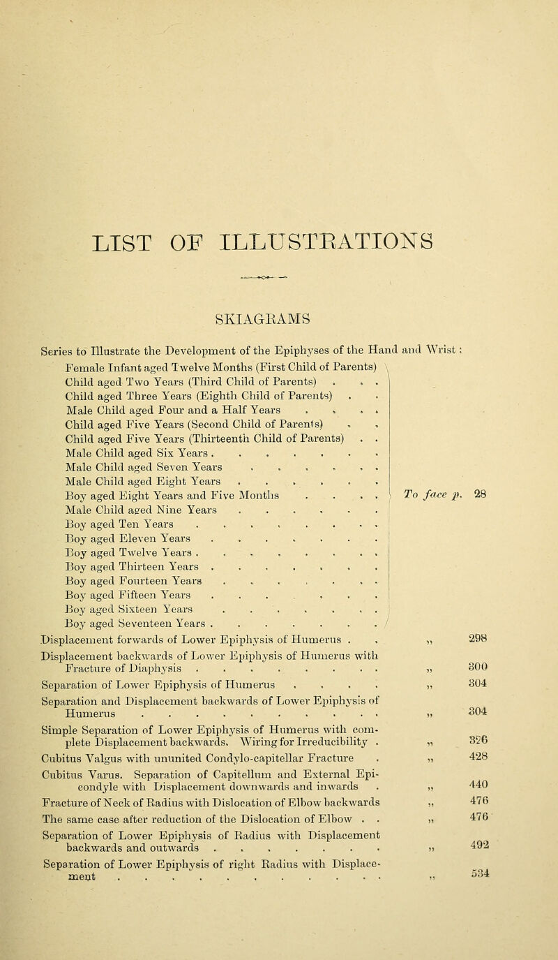 LIST OF ILLUSTEATIONS SKIAGEAMS with sis of To face p, 28 Series to Illustrate the Development of the Epiphyses of the Hand and Wrist Female Infant aged Twelve Months (First Child of Parents) ^^ Child aged Two Years (Third Child of Parents) Child aged Three Years (Eighth Child of Parents) Male Child aged Four and a Half Years Child aged Five Years (Second Child of Parents) Child aged Five Years (Thirteenth Child of Parents) Male Child aged Sis l^ears . Male Child aged Seven Years Male Child aged Eight Years Boy aged Eight Years and Five Months Male Child agred Nine Years Boy aged Ten Years Boy aged Eleven Years Boy aged Twelve Years . Boy aged Thirteen Years . Boy aged Fourteen Years Boy aged Fifteen Years Boy aged Sixteen Years Boy aged Seventeen Years . Displacement forwards of Lower Epiphysis of Humerus Displacement backwards of Lower Epiphysis of Humerus Fracture of Diaph^'sis ... Separation of Lower Epiphysis of Humerus Separation and Displacement backwards of Lower Epiphys Humerus ..... Simple Separation of Lower Epiphysis of Humerus with com- plete Displacement backwards. Wiring for Irreducibility Cubitus Valgus with ununited Condylo-capitellar Fracture Cubitus Varus. Separation of Capitellum and External Epi- condyle with Displacement downwards and inwards Fracture of Neck of Radius with Dislocation of Elbow backwards The same case after reduction of the Dislocation of Elbow Separation of Lower Epiphysis of Radius with Displacement backwards and outwards ...... Separation of Lower Epiphysis of right Radius with Displace ment / 29B 800 304 304 356 428 440 476 476 492 534