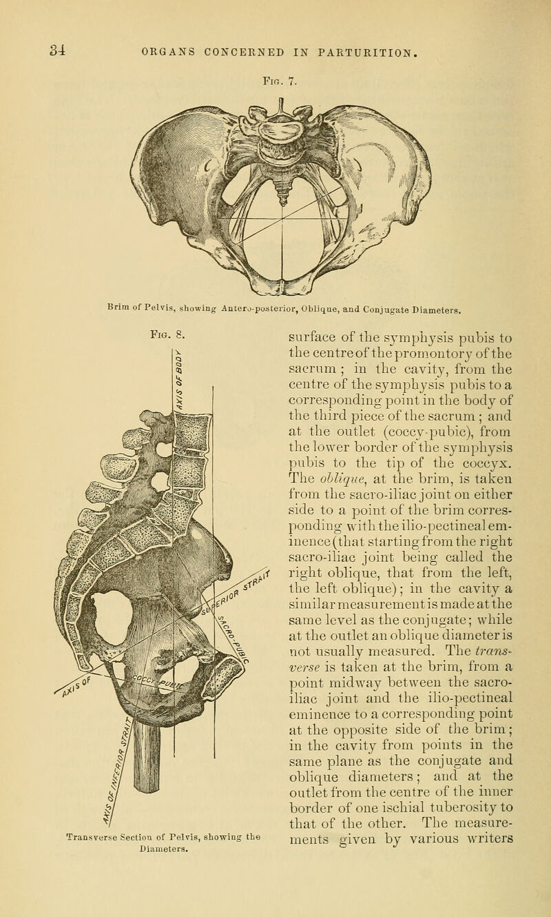 Fig. 7. Brim of Pelvis, showing Antero-posterior, Oblique, and Conjugate Diameters. Fig. 8. sverse Section of Pelvis, showing the Diameters. surface of the symphysis pubis to the centre of the promontor}^ of the sacrum ; in the cavity, from the centre of the symphysis pubis to a corresponding point in the body of the third piece of the sacrum ; and at the outlet (coccy-pubic), from the lower border of the symphysis pubis to the tip of the coccyx. The oblique^ at the brim, is taken from the sacro-iliac joint on either side to a point of the brim corres- ponding with the ilio-pectineal em- inence (that starting from the right sacro-iliac joint being called the right oblique, that from the left, the left oblique); in the cavity a similar measurement is made at the same level as the conjugate; while at the outlet an oblique diameter is not usually measured. The trans- verse is taken at the brim, from a point midway between the sacro- iliac joint and the ilio-pectineal eminence to a corresponding point at the opposite side of the brim; in the cavity from points in the same plane as the conjugate and oblique diameters; and at the outlet from the centre of the inner border of one ischial tuberosity to that of the other. The measure- ments given by various writers