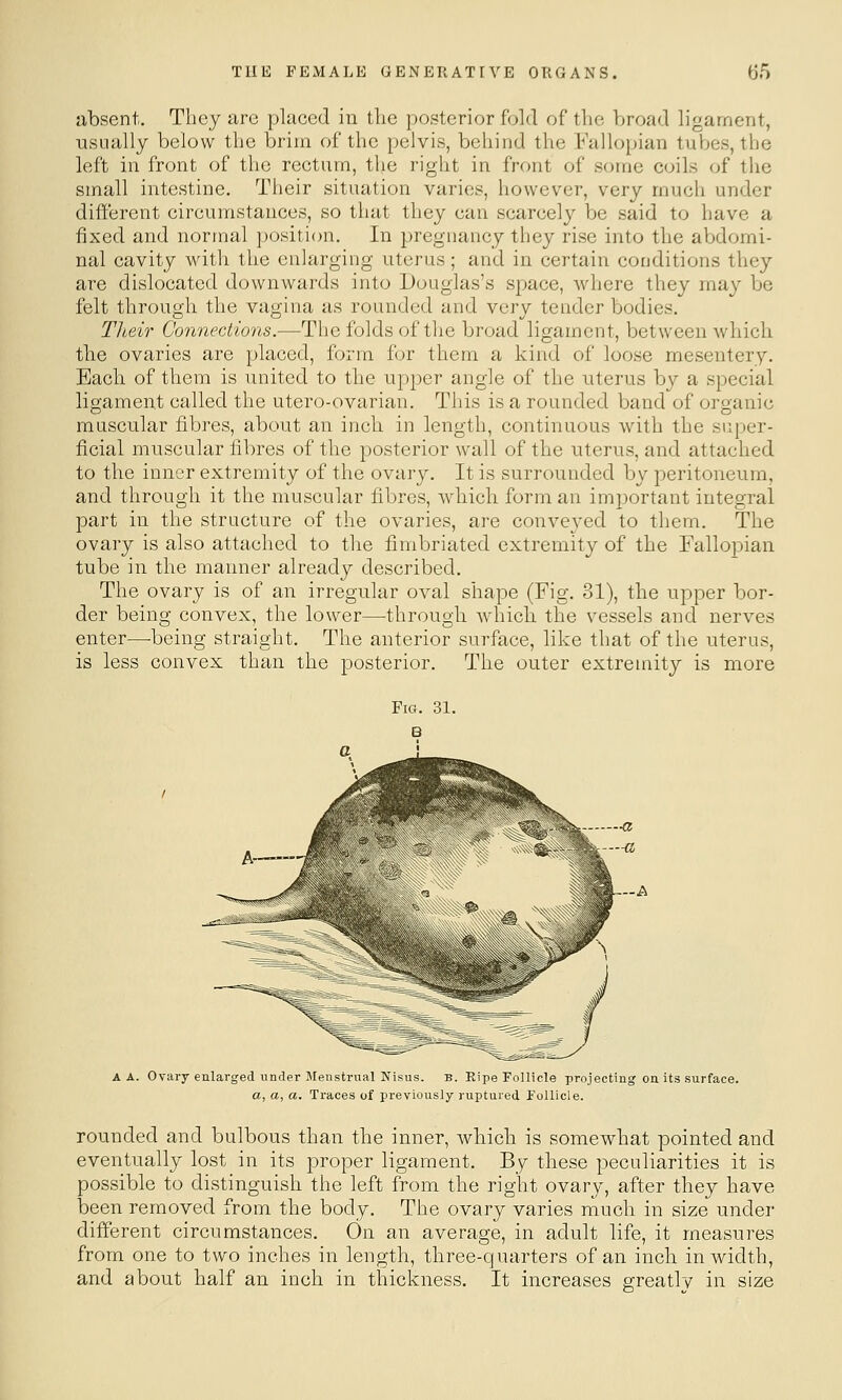 absent. They are placed in the posterior fold of tlie broad ligament, usually below the brim of the pelvis, behind the Fallopian tuljes, the left in front of the rectum, the right in front of some coils of the small intestine. Their situation varies, however, very much under different circumstances, so that they can scarcely be said to have a fixed and normal position. In pregnancy they rise into the abdomi- nal cavity with the enlarging uterus; and in certain conditions they are dislocated downwards into Douglas's space, where they may be felt through the vagina as rounded and Yery tender bodies. Their Connections.—The folds of the broad ligament, between which the ovaries are placed, form for them a kind of loose mesentery. Each of them is united to the upper angle of the uterus by a special ligament called the utero-ovarian. This is a rounded band of organic muscular fibres, about an inch in length, continuous with the super- ficial muscular fibres of the posterior wall of the uterus, and attached to the inner extremity of the ovary. It is surrounded by peritoneum, and through it the muscular fibres, which form an important integral part in the structure of the ovaries, are conveyed to them. The ovary is also attached to the fimbriated extremity of the Fallopian tube in the manner already described. The ovary is of an irregular oval shape (Fig. 31), the upper bor- der being convex, the lower—through which the vessels and nerves enter—-being straight. The anterior surface, like that of the uterus, is less convex than the posterior. The outer extremity is more A A. Ovary enlarged under Menstrual Nisus. b. Ripe Follicle projecting on its surface. a, a, a. Traces of previously ruptured Follicle. rounded and bulbous than the inner, which is somewhat pointed and eventually lost in its proper ligament. By these peculiarities it is possible to distinguish the left from the right ovary, after they have been removed from the body. The ovary varies much in size under different circumstances. On an average, in adult life, it measures from one to two inches in length, three-quarters of an inch in width, and about half an inch in thickness. It increases greatlv in size