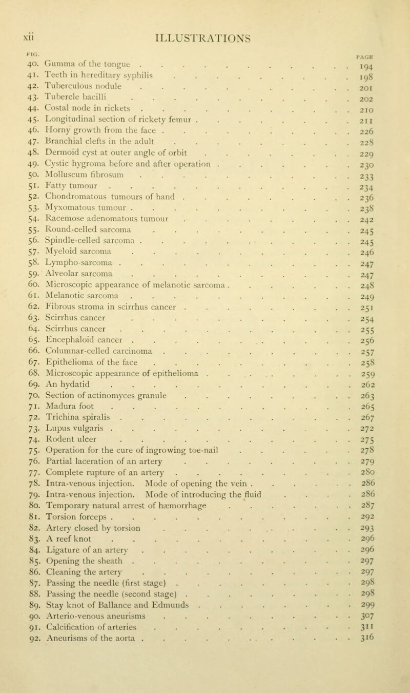 40. 41. 42. 43- 44. 45- 46. 47- 48. 49- 50. 51- 52- 53- 54- 55- 56. 57- 58. 59- 60. 61. 62. 63- 64. 65- 66. 67. 68. 69. 70. 71. 72. 73- 74- 75- 76. 77- 78. 79- 80. 81. 82. 83- 84. 85. 86. 87. Gumma of ihe tongue .... Teeth in hereditary svphilis Tuberculous nodule .... Tubercle bacilli .... Costal node in rickets .... Longitudinal section of rickety femur . Horny growth from the face . Hranchial clefts in the adult Dermoid cyst at outer angle of orbit Cystic hygroma before and after operation Molluscum fibrosum Fatty tumour .... Chondromatous tumours of hand Myxomatous tumour . Racemose adenomatous tumour Round-celled sarcoma Spindle-celled sarcoma . Myeloid sarcoma Lympho-sarcoma . Alveolar sarcoma ....... Microscopic appearance of melanotic sarcoma . Melanotic sarcoma ....... Fibrous stroma in scirrhus cancer .... Scirrhus cancer ....... Scirrhus cancer ....... Encephaloid cancer . . . . . . . Columnar-celled carcinoma ..... Epithelioma of the face ...... Microscopic appearance of epithelioma . An hydatid ........ Section of actinomyces granule .... Madura foot ........ Trichina spiralis ....... Lupus vulgaris ........ Rodent ulcer ....... Operation for the cure of ingrowing toe-nail Partial laceration of an artery .... Complete rupture of an artery . . . . . Intra-venous injection. Mode of opening the vein . Intra-venous injection. Mode of introducing the fluid Temporary natural arrest of hivmorrhage Torsion forceps ........ Artery closed by torsion ..... A reef knot ........ Ligature of an artery ...... Opening the sheath ....... Cleaning the artery ...... Passing the needle (first stage) . . . . . Passing the needle (second stage) .... Stay knot of Ballance and Edmunds . . . . Arterio-venous aneurisms ..... Calcification of arteries ...... Aneurisms of the aorta ......
