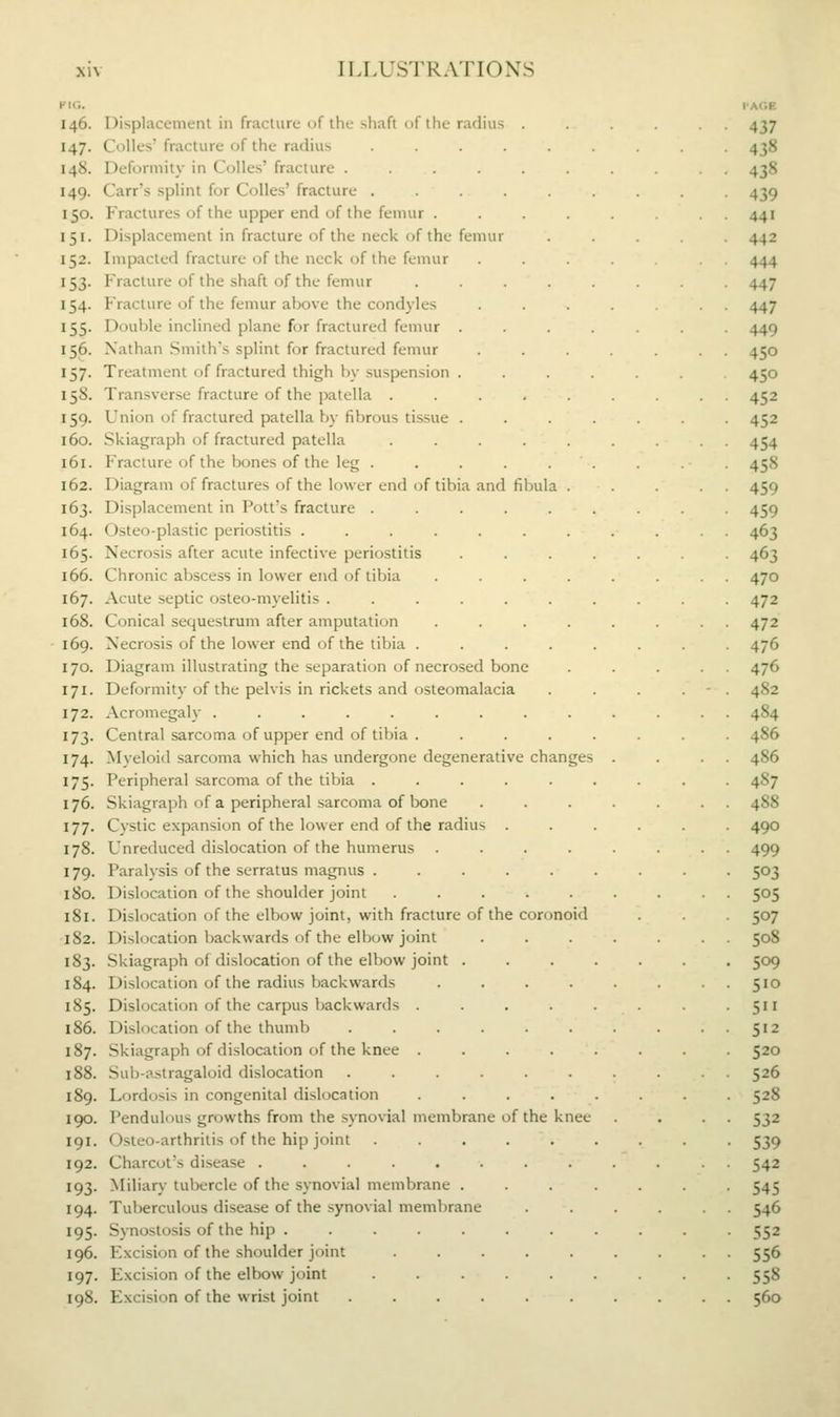 KIG. 146. Displacement in fracture of the shaft of the rathus . 147. Colles' fracture of the radius ...... 148. Deformity in Colles' fracture ...... 149. Carr's splint for Colles' fracture ...... 150. Fractures of the upper end of the femur .... 151. Displacement in fracture of the neck of the femur 152. Impacted fracture of the neck of the femur 153. Fracture of the shaft of the femur . . . . . 154. Fracture of the femur above the condyles 155. Double inclined plane for fractured femur .... 156. Nathan Smith's splint for fractured femur 157. Treatment of fractured thigh by suspension .... 158. Transverse fracture of the patella ..... 159. Union of fractured patella by fibrous tissue . . . . 160. Skiagraph of fractured patella ..... 161. Fracture of the bones of the leg ...... 162. Diagram of fractures of the lower end of tibia and fibula . 163. Displacement in Pott's fracture ...... 164. Osteo-plastic periostitis ....... 165. Necrosis after acute infective periostitis . . . . 166. Chronic abscess in lower end of tibia .... 167. Acute septic osteo-myelitis ....... 168. Conical sequestrum after amputation .... 169. Necrosis of the lower end of the tibia ..... 170. Diagram illustrating the separation of necrosed bone 171. Deformity of the pelvis in rickets and osteomalacia 172. Acromegaly ......... 173. Central sarcoma of upper end of tibia . . . . . 174. Myeloid sarcoma which has undergone degenerative changes 175. Peripheral sarcoma of the tibia ...... 176. Skiagraph of a peripheral sarcoma of bone 177. Cystic expansion of the lower end of the radius . 178. Unreduced dislocation of the humerus .... 179. Paralysis of the serratus magnus ...... 180. Dislocation of the shoulder joint ..... 181. Dislocation of the elbow joint, with fracture of the coronoid •182. Dislocation backwards of the elbow joint 183. Skiagraph of dislocation of the elbow joint . 184. Dislocation of the radius backwards 185. Dislocation of the carpus backwards . 186. Dislocation of the thumb .... 187. Skiagraph of dislocation of the knee . 188. Sub-astragaloid dislocation .... 189. Lordosis in congenital dislocation 190. Pendulous growths from the synovial membrane of the 191. Osteo-arthritis of the hip joint 192. Charcot's disease ...... 193. Miliary tubercle of the synovial membrane . 194. Tuberculous disease of the synovial membrane 195. Synostosis of the hip ..... 196. Excision of the shoulder joint 197. Excision of the elbow joint 198. Excision of the wrist joint .... knee