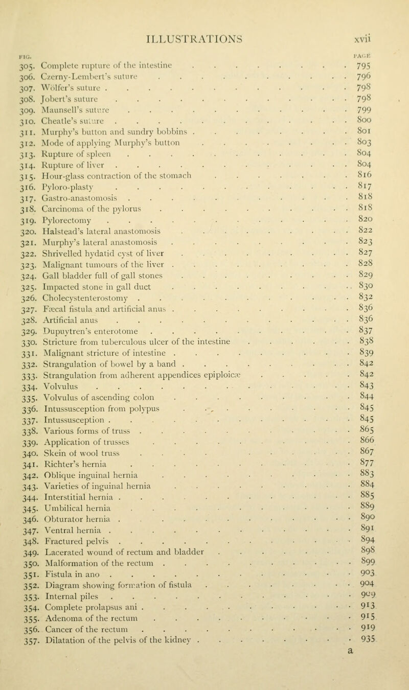 I-IG. I'ACE 305. Complete rupture of tlic iiilestinc ........ 795 306. C/.erny-Lemhert's suture .......... 796 307. Wiilfer's suture 79^ 308. Jobert's suture ............ 798 309. Maunsell's suture ........... 799 310. Cheatle's sulure ............ 800 311. Murphy's button and sundry boljbins ........ 801 312. Mode of applying Murphy's button ........ 803 313. Rupture of .spleen ........... 804 314. Rupture of liver ............ 804 315. Hour-gla.ss contraction of the stomach ....... 816 316. Pyloro-plasty 817 317. Gastro-anastomosis . . . . . . . . • .818 318. Carcinoma of the pylorus . . . . . . . . . . 818 319. Pylorectomy ............ 820 320. Halstead's lateral anastomosis • ■ 822 321. Murphy's lateral anastomosis ......... 823 322. Shrivelled hydatid cy.st of liver . 827 323. Malignant tumours of the liver ......... 828 324. Gall bladder full of gall stones ......... 829 325. Impacted stone in gall duct . . ■ . ■ • • ■ ■ • 830 326. Cholecystenterostomy ........... 832 327. Fascal fistula and artificial anus .......■• 836 328. Artificial anus 836 329. Dupuytren's enterotome ........•• 837 330. Stricture from tuberculous ulcer of the intestine . . . . . • 838 331. Malignant stricture of intestine ......... 839 332. Strangulation of bowel by a band 842 333. Strangulation from adherent appendices epiploic^ ..... 842 334. Volvulus 843 335. Volvulus of ascending colon ......... 844 336. Intussusception from polypus . • , • ■ • ■ • • 845 337. Intussusception ......•••••• 845 338. Various forms of truss .....••.•■• 865 339. Application of trusses .....■••■ 866 340. Skein of wool truss .... ...... 067 341. Richter's hernia ......••■• 877 342. Oblique inguinal hernia .....•••■• 883 343. Varieties of inguinal hernia .....-••• 884 344. Interstitial hernia .....■•••••• 885 345. Umbilical hernia ......-•••• 889 346. Obturator liernia 890 347. Ventral hernia . . . . • • • • • • • .891 348. Fractured pelvis 894 349. Lacerated wound of rectum and bladder ...... 898 350. Malformation of the rectum ......•••• 899 351. Fistula in ano 903 352. Diagram showing forn^a'ion of fistula .....••■ 9^4 353. Internal piles 9'-'9 354. Complete prolapsus ani . . . . . . • • • • ■ 9^3 355. Adenoma of the rectum . . . . • • ■ • • • 9^5 356. Cancer of the rectum ......-•••• 9^9 357- Dilatation of the pelvis of the kidney 935 a