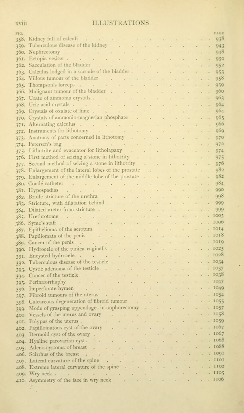 FIC, I'ACE 358. Kidney full of calculi 938 359. Tuberculous disease of the kidney ........ 943 360. Nephrectomy ............ 948 361. Ectopia vesica' 950 362. Sacculation of the bladder .......... 952 363. Calculus lodged in a saccule of the bladder ....... 953 364. Villous tumour of the l)ladder ......... 958 365. Thompson's forceps ........... 959 366. Malignant tumour of the bladder 960 367. Urate of ammonia crystals .......... 963 368. Uric acid crystals ............ 964 369. Crj-stals of oxalate of lime .......... 964 370. Crystals of ammonio-magnesian phosphate ....... 965 371. Alternating calculus 966 372. Instruments for lithotomy 969 373. Anatomy of parts concerned in lithotomy ....... 970 374. Petersen's bag ............ 972 375. Lithotrite and evacuator for litholapaxy 974 376. First method of seizing a stone in lithotrity 975 377. Second method of seizing a stone in lithotrity ...... 976 378. Enlargement of the lateral lobes of the prostate 982 379. Enlargement of the middle lobe of the prostate 982 380. Coude catheter ............ 984 381. Hypospadias 99° 382. Bridle stricture of the urethra ......... 998 383. Stricture, with dilatation behind 999 384. Dilated ureter from stricture 999 385. Urethrotome 1005 386. Syme's staff 1006 387. Epithelioma of the scrotum 1014 388. Papillomata of the penis 1018 389. Cancer of the penis 1019 390. Hydrocele of the tunica vaginalis 1025 391. Encysted hydrocele 1028 392. Tuberculous disease of the testicle 1034 393. Cystic adenoma of the testicle ... 1037 394. Cancer of the testicle 103S 395. Perinjeorrhaphy ......■•• 1047 396. Imperforate hymen .... 1049 397. Fibroid tumours of the uterus 1054 398. Calcareous degeneration of fibroid tumour 1055 399. Mode of grasping appendages in oophorectomy 1057 400. Vessels of the uterus and ovary ........ 1058 401. Polypus of the uterus ......••■ 1059 402. Papillomatous cyst of the ovar)- 1067 403. Dermoid cyst of the ovary 1067 404. Hyaline parovarian cyst 1068 405. Adeno-cystoma of breast ......■•• 10S8 406. Scirrhus of the breast ......■••• 1091 407. Lateral curvature of the spine ......■•• uoi 408. Extreme lateral cur\ature of the spine H02 409. Wry neck ' io5 410. Asymmetry of the face in wry neck . . • • . . 1106