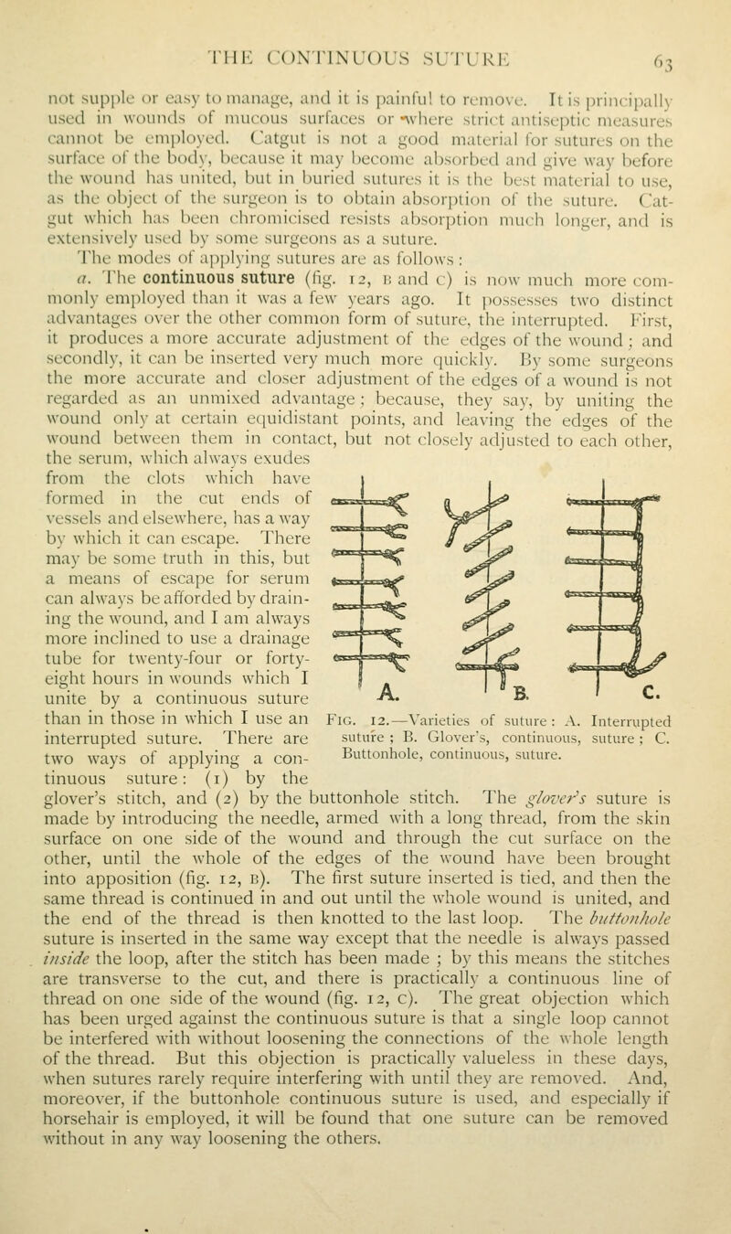 rill': CONTINUOUS sutukp: ^^3 not supple or easy to manage, and it is [)ainlu! to remo\e. It is principally used in wounds of mucous surfaces or -where strict antiseptic measures cannot be employed. Catgut is not a good material for sutures on the surface of tlie body, because it may become absorbed and give way before the wound has uiiited, but in buried sutures it is the best material to use, as the object of the surgeon is to obtain absorption of the suture. Cat- gut which has been chromicised resists absorption much longer, and is extensively used by some surgeons as a suture. The modes of applying sutures are as follows : a. The continuous suture (fig. 12, b and c) is now much more com- monly employed than it was a few years ago. It possesses two distinct advantages over the other common form of suture, the interrupted. First, it produces a more accurate adjustment of the edges of the wound ; and secondly, it can be inserted very much more quickly. By some surgeons the more accurate and closer adjustment of the edges of a wound is not regarded as an unmixed advantage ; because, they say, by uniting the wound only at certain equidistant points, and leaving the edges of the wound between them in contact, but not closely adjusted to each other, the serum, which always exudes from the clots which have formed in the cut ends of vessels and elsewhere, has a way by which it can escape. There may be some truth in this, but a means of escape for serum can always be afforded by drain- ing the wound, and I am always more inclined to use a drainage tube for twenty-four or forty- eight hours in wounds which I unite by a continuous suture than in those in which I use an interrupted suture. There are two ways of applying a con- tinuous suture: (i) by the glover's stitch, and (2) by the buttonhole stitch. The glover's suture is made by introducing the needle, armed with a long thread, from the skin surface on one side of the wound and through the cut surface on the other, until the whole of the edges of the wound have been brought into apposition (fig. 12, b). The first suture inserted is tied, and then the same thread is continued in and out until the whole wound is united, and the end of the thread is then knotted to the last loop. The buttonhole suture is inserted in the same way except that the needle is always passed inside the loop, after the stitch has been made ; by this means the stitches are transverse to the cut, and there is practically a continuous line of thread on one side of the wound (fig. 12, c). The great objection which has been urged against the continuous suture is that a single loop cannot be interfered with without loosening the connections of the whole length of the thread. But this objection is practically valueless in these days, when sutures rarely require interfering with until they are removed. And, moreover, if the buttonhole continuous suture is used, and especially if horsehair is employed, it will be found that one suture can be removed without in any way loosening the others. Fig. 12.—Varieties of suture : A. Interrupted suture ; B. Glover's, continuous, suture; C. continuous, suture. Buttonhole,