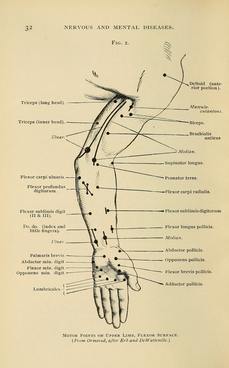 Fig. 2. Triceps (long head) Triceps (inner head) Ulnar. Flexor carpi ulnaris. Flexor profundus digitorum. Flexor sublimis digit (II & III). Do. do. (index and little fingers). Ulna Palmaris brevis Abductor min. digit Flexor min. digit Opponens min. digit XfUmbricales. Median. Supinator longus. Pronator teres. Deltoid (ante- rior portion). Musculo- cutaneous. Biceps. Brachialis anticus Flexor carpi radialis. Flexor sublimis digitorum Flexor longus pollicis. Median. Abductor pollicis. Opponens pollicis. Flexor brevis pollicis. Adductor pollicis. Motor Points on Upper IvImb, Flexor Surface.