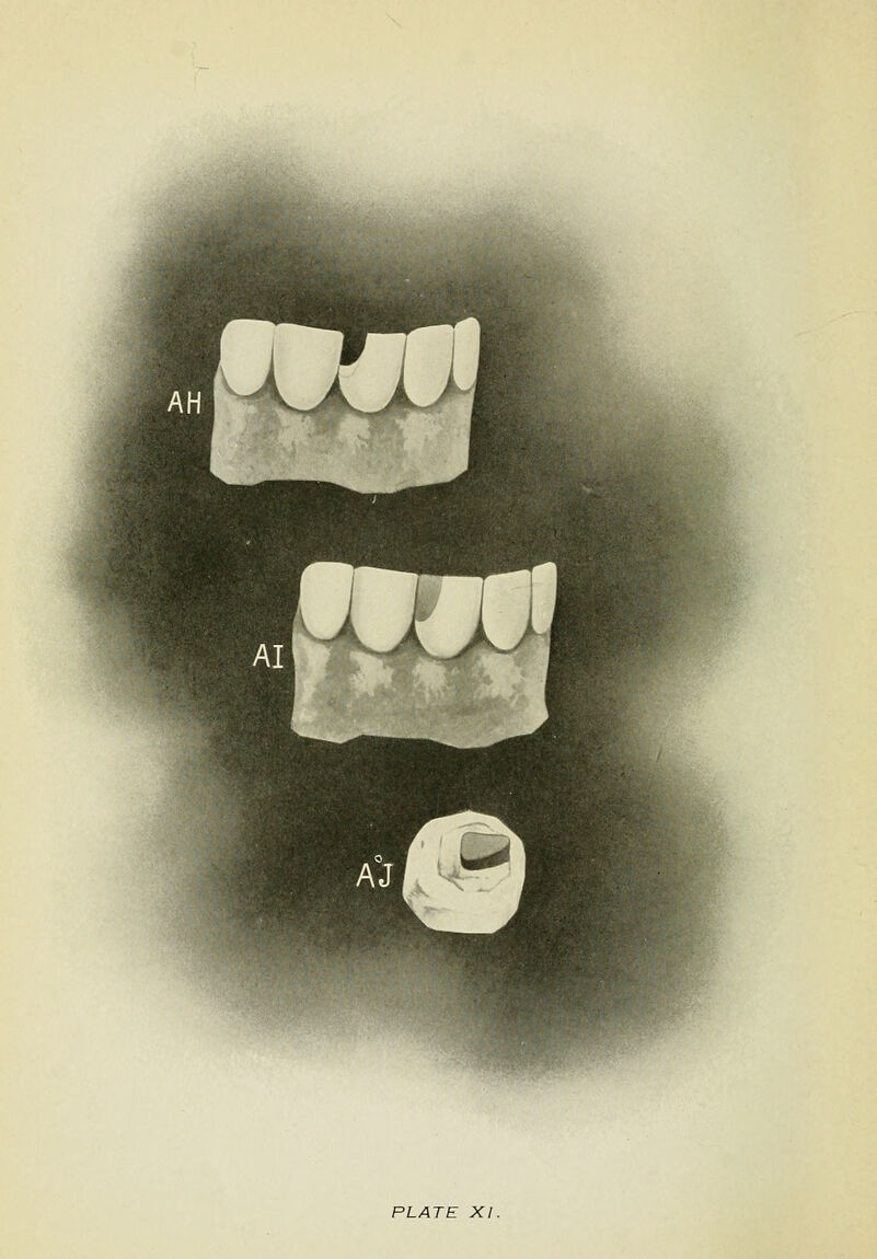 PLATE XI.