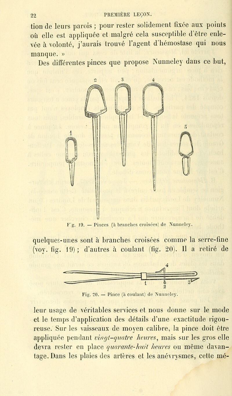 tion de leurs parois ; pour rester solidement fixée aux points oii elle est appliquée et malgré cela susceptible d'être enle- vée à volonté, j'aurais trouvé l'agent d'hémostase qui nous manque. » Des différentes pinces que propose Nunneley dans ce but, F'g. 19. —Pinces (à branches croisées) de Nunneley. quelques-unes sont à branches croisées comme la serre-fine (yov. fig. 19); d'autres à coulant (fig. 20). Il a retiré de =^ Fig. '20. — Pince (à coulant) de Nunneley. leur usage de véritables services et nous donne sur le mode et le temps d'application des détails d'une exactitude l'igou- reuse. Sur les vaisseaux de moyen calibre, la pince doit être appliquée pendant vingt-quatre heures^ mais sur les gros elle devra rester en place quarante-huit heures ou même davan- tage. Dans les plaies des artères et les anévrysmes, cette mé-
