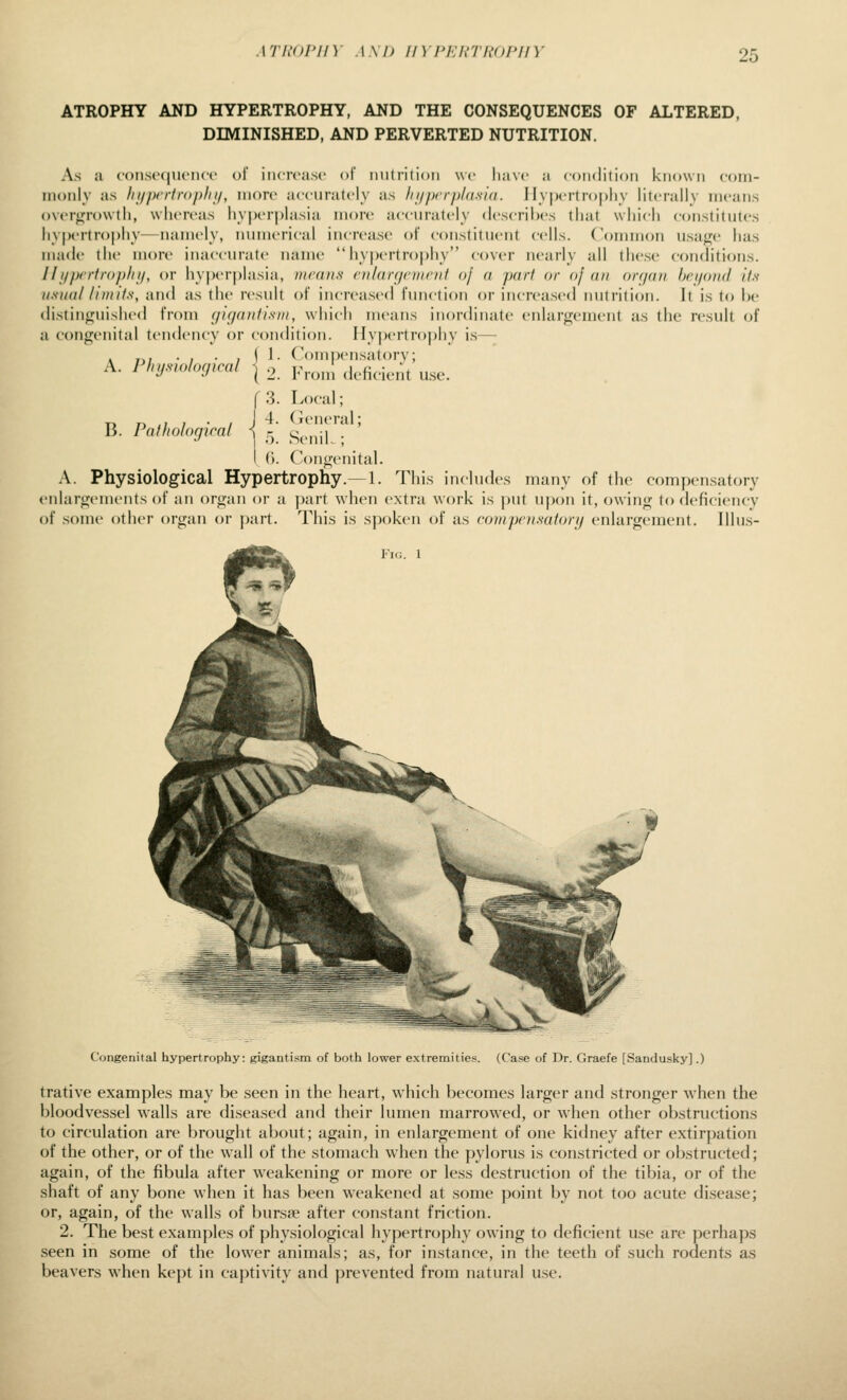 ATh'OPny AM) in rERTROPHY ATROPHY AND HYPERTROPHY, AND THE CONSEQUENCES OF ALTERED, DIMINISHED, AND PERVERTED NUTRITION. As a consccnuMicc ol increase of luitritioii we luive a coiKlilion known eoni- monly as liijpr tiro phi/, more accurately as /iijprrp/asid. Ilypertrojjhy literally means overfjrowth, whereas hyperj)lasia more accurately describes that which constitutes hy|)ertro])hy—namely, numerical increase of constituent cells, ('omnion usaj^e has made the more inaccurate name hy|)ertroj)hy cover nearly all the.se conditions. IIi/prrtrop/ii/, or hy|)er|)lasia, inranfi nilarfjniirnf of a part or of an orcjan hcijotid its usuaWnuits, and as the result of increased function or increased nutrition. It is to he distinijuished from (/u/anfisni, which means inordinate enlargement as the result of a congenital tendency or condition. Hypertrophy is— I ]. Compensatory; \ 2. l''rom deficient u.se. Local; (ieneral; SeniL ; I (). Congenital. A. Physiological Hypertrophy.—1. This includes many of the compensatory enlargements of an organ or a |)art when extra work is put upon it, owing to deficiency of some other organ or part. This is spoken of as coinpt'tisatoni enlargement. Illus- FlG. 1 A. P/iijsiohx/ira/ 3. B. Pathological i - Congenital hypertrophy: gigantism of both lower extremities. (Case of Dr. Graefe [Sandusky].) trative examples may be seen in the heart, which becomes larger and stronger when the bloodves.sel walls are diseased and their lumen marrowed, or when other obstructions to circulation are brought about; again, in enlargement of one kidney after extirpation of the other, or of the wall of the stomach w^hen the pylorus is constricted or obstructed; again, of the fibula after weakening or more or less destruction of the tibia, or of the shaft of any bone when it has been weakened at some point by not too acute disease; or, again, of the walls of bursse after constant friction. 2. The best examples of physiological hypertrophy owing to deficient use are perhaps seen in some of the lower animals; as, for instance, in the teeth of such rodents as beavers when kept in ca))tivity and prevented from natural use.