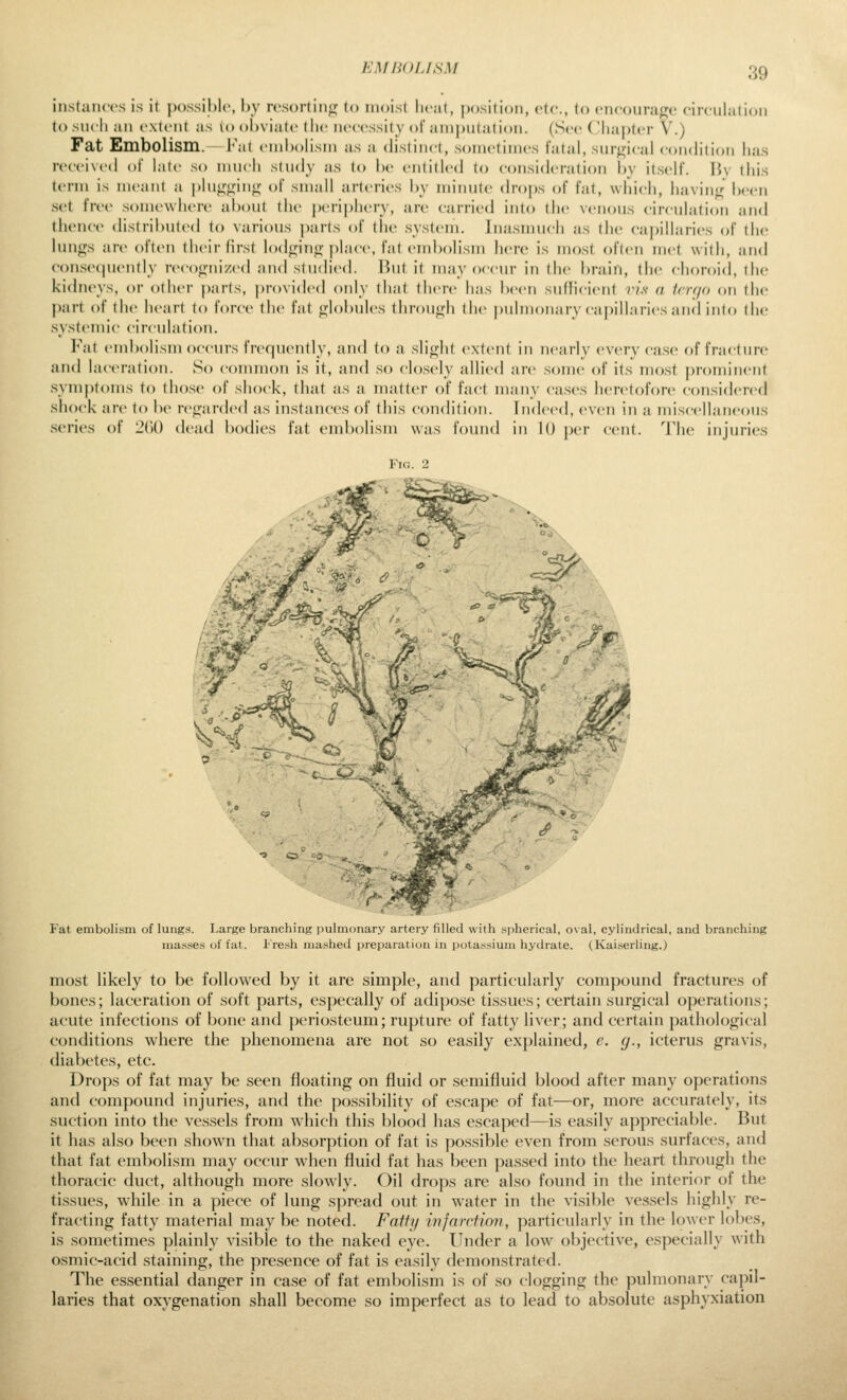 KM HOLISM iiistaiHcs is it possible, by rcsortiiitf (o moist liciit, position, vU-., to cnroura^o circulation tosncli an extent as vo ()l)viiitc the necessity ol'amputation. (See ('lia])ter V.) Fat Embolism.—Fat embolism as a distinct, sometimes fatal, surgical condition lia.s received of laic so much study as to be entitled to consideration l)y itself. \\\ this term is meant a plu^'^iiifj; of small arteries by minute drops of fat, which, havinji; been set free somewhere about the j)eri|)hery, are carried into the venous circulation and thence distributed to various parts of the .system. Inasmuch as the capillaries of the lungs are often their first lodginji j)lace, fat embolism lierc is most often met with, and eonse(|uently recofjnized and studied. But it may occur in the brain, the choroid, the kidneys, or other parts, provided only that there has been sufKcient i7.<f a trn/o on the part of the heart to force the fat globules through the pulmonary capillaries and into the .syst(Miiic circulation. Fat embolism occurs fi'cquently, and to a slight extent in nearly every case of fracture and laceration. So connnon is it, and so closely allied are some of its most prominent syni|)toms to those of shock, that as a matter of fact many ca.ses heretofore considered shock are to be n'garded as instances of this condition. Indeed, even in a miscellaneous series of 2(J0 dead bodies fat embolism was found in 10 per cent. The injuries Fig. 2 Fat embolism of lungs. Large branching pulmonary artery filled with spherical, o\al, cylindrical, and branching nias.ses of fat. l''re.>sh mashed preparation in potassium hydrate. (Kaiserling.) most likely to be followed by it are simple, and particularly compound fractures of bones; laceration of soft parts, especally of adi})ose tissues; certain surgical operations; acute infections of bone and periosteum; rupture of fatty liver; and certain pathological conditions where the phenomena are not so easily explained, e. g., icterus gravis, diabetes, etc. Drops of fat may be seen floating on fluid or semifluid blood after many operations and compound injuries, and the possibility of escape of fat—or, more accurately, its suction into the vessels from which this blood has escaped—is easily appreciable. But it has also been shown that absorption of fat is possible even from serous surfaces, and that fat embolism may occur when fluid fat has been passed into the heart through the thoracic duct, although more slowly. Oil drops are also foxmd in the interior of the tissues, while in a piece of lung spread out in water in the visible vcs.sels highly re- fracting fatty material may be noted. Fatty injarction, particularly in the lower lobes, is sometimes plainly visible to the naked eye. Under a low objective, especially with osmic-acid staining, the presence of fat is easily demonstrated. The es.sential clanger in ca.se of fat embolism is of so clogging the pulmonary capil- laries that oxygenation shall becom.e so imperfect as to lead to absolute asphyxiation