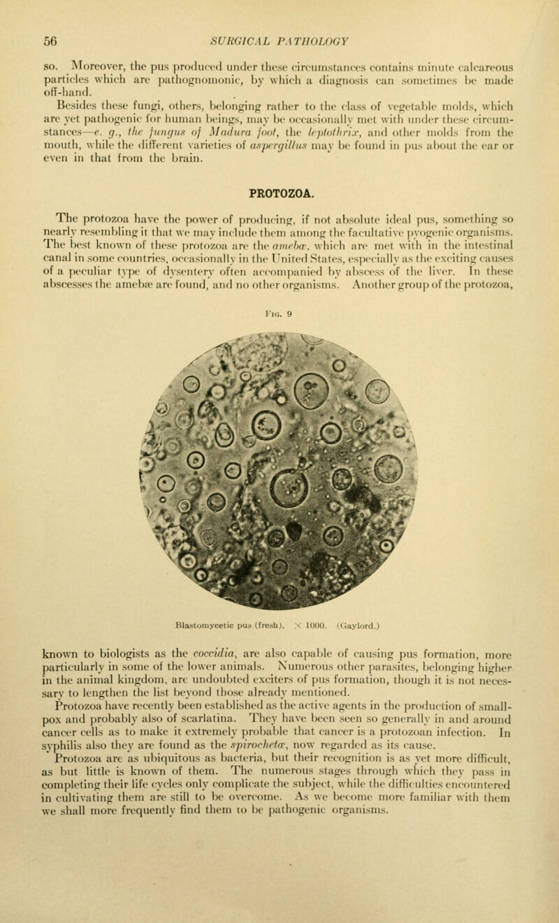 so. Moreover, the pus producetl under these (inuiiistances contains minute calcareous particles which are pathognomonic, by which a diagnosis can sometimes be made off-hand. Besides these fungi, others, belonging rather to the class of vegetable molds, which are yet pathogenic for human beings, may be occasionally met with under these circum- stances—e. g., ilir fiingns of Mcuhtra foot, the Icptothrix, and other molds from the mouth, while the different varieties of aspi'ujilln.s may be found in pus about the ear or even in that from the brain. PROTOZOA. The protozoa have the power of producing, if not absolute ideal pus, something so nearly resembling it that we may include them among the facultative pyogenic organisms. The best known of these protozoa are the amrlxr. which are met with in the intestinal canal in some countries, occasionally in the I'nited .States, especially as the exciting cau.ses of a peculiar type of dysentery often accompanied by abscess of the liver. In these abscesses the amebje are found, and no other organisms. Another group of the protozoa. Fig. 9 -b(? Blastomycetic pus (fresh;. 1000. KJaylord.) known to biologists as the coccidia, are also capable of causing pus formation, more particularly in some of the lower animals. Numerous other parasites, belonging higher in the animal kingdom, are undoubted exciters of pus formation, though it is not neces- sary to lengthen the li.st beyond those already mentioned. Protozoa have recently been established as the active agents in the production of small- pox and probably also of scarlatina. They have been .seen so generally in and around cancer cells as to make it extremely probable that cancer is a protozoan infection. In syphilis also they are found as the spirochrto', now n^garded as its cause. Protozoa are as ubiquitous as bacteria, but their recognition is as yet more difficult, as but little is known of them. The numerous stages through which they pass in completing their life cycles only complicate the subject, while the difficulties encountered in cultivating them are still to be overcome. As we become more familiar with them we shall more frequently find them lo be pathogenic organisms.