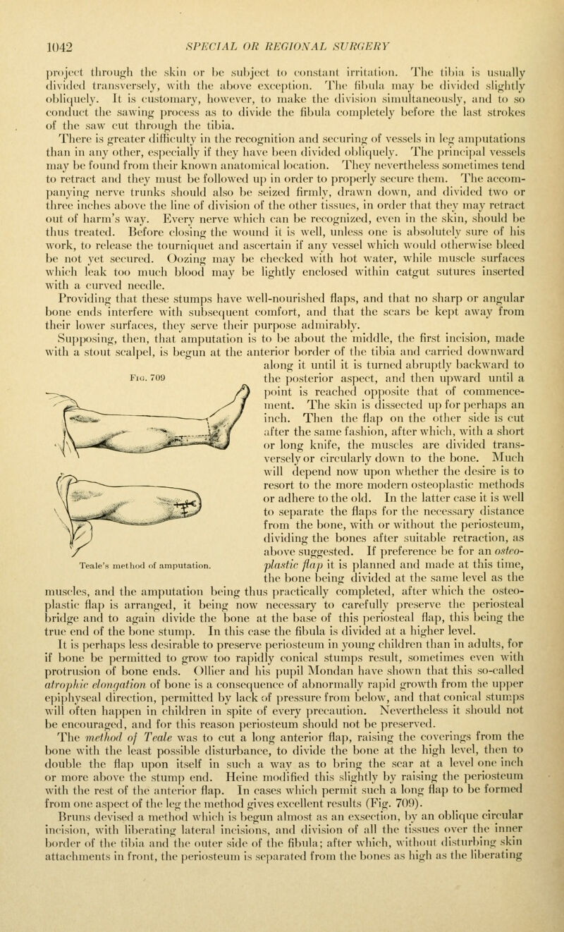 Fig. 709 ])r()jcct tliroutijh the skin or he subject to constiuit irritation. The tibia is usually (Hvided transversely, with the above exee})tion. The fibula may be divided slightly obliquely. It is eustoniary, however, to make the division simultaneously, and to so conduct the sawing process as to divide the fibula completely before the last strokes of the saw cut through the tibia. There is greater difficulty in the recognition and securing of vessels in leg amjiutations than in any other, especially if they have been divided obliquely. The principal vessels may be found from their known anatomical location. They nevertheless sometimes tend to retract and they must be followed up in order to properly secure them. The accom- panying nerve trunks should also be seized firmly, drawn down, and divided two or three inches above the line of division of the other tissues, in order that they may retract out of harm's way. Every nerve which can be recognized, even in the skin, should be thus treated. Before closing the wound it is well, unless one is absolutely sure of his w^ork, to release the tourniquet and ascertain if any vessel which would otherwise bleed be not yet secured. Oozing may be checked w'ith hot water, wdiile muscle surfaces which leak too much blood may be lightly enclosed within catgut sutures inserted with a curved needle. Providing that these stumps have well-nourished flaps, and that no sharp or angular bone ends interfere with subsequent comfort, and that the scars be kept away from their lower surfaces, they serve their purpose admirably. Su]:>posing, then, that amputation is to l)e about the middle, the first incision, made with a stout scalpel, is begun at the anterior border of the tibia and carried downward along it until it is turned abruptly backward to the posterior aspect, and then upward until a point is reached opposite that of commence- ment. The skin is dissected up for perhaps an inch. Then the flap on the other side is cut after the same fashion, after which, wnth a short or long knife, the muscles are divided trans- versely or circularly down to the bone. Much will depend now upon whether the desire is to resort to the more modern osteoplastic methods or adhere to the old. In the latter case it is well to separate the flaps for the necessary distance from the bone, w ith or without the periosteum, dividing the bones after suitable retraction, as above suggested. If preference be for an osteo- plastic flap it is planned and made at this time, the l)one being divided at the same level as the muscles, and the amputation being thus practically completed, after which the osteo- plastic flaj) is arranged, it being now necessary to carefully preserve the periosteal bridge and to again divide the bone at the base of this ]:)eriosteal flap, this being the true end of the bone stump. In this case the fibula is divided at a higher level. It is perhaps less desirable to preserve periosteum in young children than in adults, for if bone be permitted to grow^ too rapidly conical stumps result, sometimes even with protrusion of bone ends. Oilier and his pupil Mondan have shown that this so-called atrophic elo7ir/ation of bone is a consequence of abnormally rapid grow^th from the upper e))iphyseal direction, ])ermitted by lack of pressure from below, and that conical stumps will often happen in children in spite of every precaution. Nevertheless it should not be encouraged, and for this reason periosteum should not be preserved. The method of Teale was to cut a long anterior flap, raising the coverings from the bone w^ith the least possible disturbance, to divide the bone at the high level, then to double the flap upon itself in such a w\ay as to bring the scar at a level one inch or more above the stump end. Heine modified this slightly by raising the periosteum with the rest of the anterior flap. In cases which permit such a long flap to be formed from one aspect of the leg the method gives excellent results (Fig. 709). Bruns devised a method which is begun almost as an exsection, by an oblique circular incision, with liberating lateral incisions, and division of all the tissues over the inner border of the til)ia and the outer side of the fibula; after which, without disturbing skin attachments in front, the [jeriosteum is sejiarated from the bones as high as the liberating Teale's method of amputation.