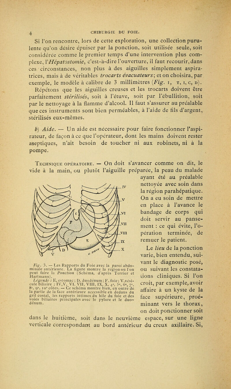 Si l'on rencontre, lors de cette exploration, une collection puru- lente qu'on désire épuiser par la ponction, soit utilisée seule, soit considérée comme le premier temps d'une intervention plus com- plexe, YHépatostomie, c'est-à-dire l'ouverture, il faut recourir, dans ces circonstances, non plus à des aiguilles simplement aspira- trices, mais à de véritables trocarts évacuateurs; et on choisira, par exemple, le modèle à calibre de 3 millimètres {Fig. i, t, i, c, d). Répétons que les aiguilles creuses et les trocarts doivent être parfaitement stérilisés, soit à l'étuve, soit par l'ébullition, soit par le nettoyage à la flamme d'alcool. Il faut s'assurer au préalable que ces instruments sont bien perméables, à l'aide de fils d'argent, stérilisés eux-mêmes. b) Aide. — Un aide est nécessaire pour faire fonctionner l'aspi- rateur, de façon à ce que l'opérateur, dont les mains doivent rester aseptiques, n'ait besoin de toucher ni aux robinets, ni à la pompe. Technique opératoire. — On doit s'avancer comme on dit, le vide à la main, ou plutôt l'aiguille préparée, la peau du malade ayant été au préalable nettoyée avec soin dans la région parahépatique. On a eu soin de mettre en place à l'avance le bandage de corps qui doit servir au panse- ment : ce qui évite, l'o- pération terminée, de remuer le patient. Le lieu de la ponction varie, bien entendu, sui- vant le diagnostic posé, ou suivant les constata- tions cliniques. Si l'on croit, par exemple, avoir affaire à un kyste de la face supérieure, proé- minant vers le thorax, on doit ponctionner soit dans le huitième, soit dans le neuvième espace, sur une ligne verticale correspondant au bord antérieur du creux axillaire. Si, Fig. 3. — Les Rapports du Foie avec la paroi abdo- minale antérieure. La figure montre la région ou l'on peut faire la Ponction ( Schéma, d'après Terrier et Hartmann). Légende : E, estomac ; D, duodénum ; F, foie ; V,vési- cule biliaire ; IV,V, VI, VII, VIII, IX, X, 4°, 5°, 6°, 7°, 8°, 90, 10e côtes. — Ce schéma montre bien, en outre de la partie de la face antérieure accessible en dedans du gril costal, les rapports intimes du hile du foie et des voies biliaires principales avec le pylore et le duo- dénum.