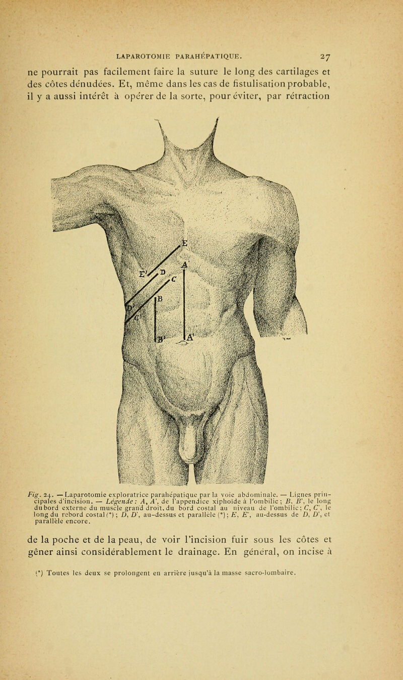 ne pourrait pas facilement faire la suture le long des cartilages et des côtes de'nudées. Et, même dans les cas de fistulisation probable, il y a aussi inte'rêt à ope'rer de la sorte, pour éviter, par rétraction Fig. 24. —Laparotomie exploratrice parahépatique parla voie abdominale. — Lignes prin- cipales d'incision. — Légende: A, A\ de l'appendice xiphoïde à l'ombilic; B, B\ le long dubord externe du muscle grand droit, du bord costal au niveau de l'ombilic; C, C\ le long du rebord costal (*) ; û, D\ au-dessus et parallèle (*); E, £, au-dessus de D, D', et parallèle encore. de la poche et de la peau, de voir l'incision fuir sous les côtes et gêner ainsi considérablement le drainage. En général, on incise à (*) Toutes les deux se prolongent en arrière jusqu'à la masse sacro-lombaire.