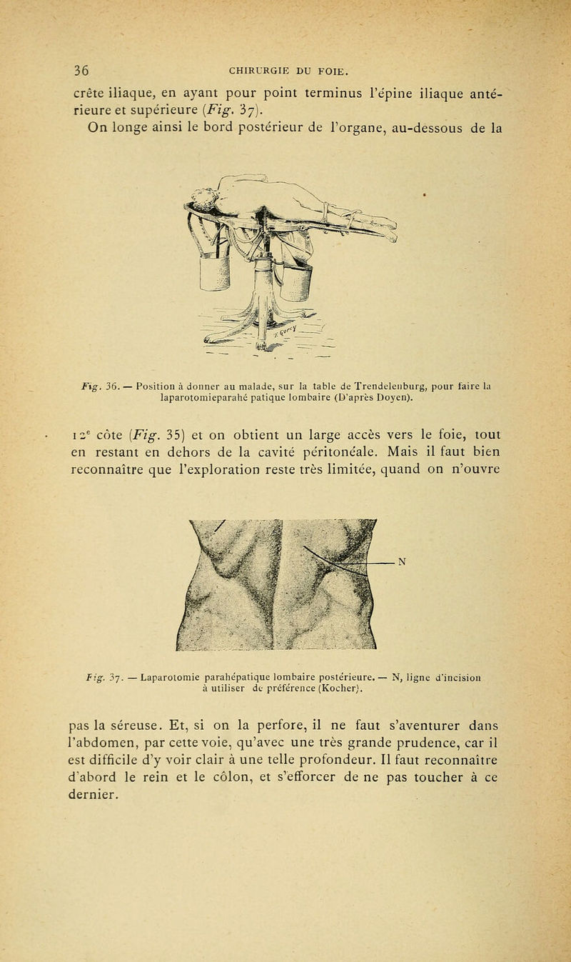 crête iliaque, en ayant pour point terminus l'épine iliaque anté- rieure et supérieure (Fig. 3y). On longe ainsi le bord postérieur de l'organe, au-dessous de la Fig. 36.— Position à donner au malade, sur la table de Trendelenburg, pour faire la laparotomieparahé patique lombaire (D'après Doyen). 12e côte [Fig. 35) et on obtient un large accès vers le foie, tout en restant en dehors de la cavité péritonéale. Mais il faut bien reconnaître que l'exploration reste très limitée, quand on n'ouvre Fig. 3j. —Laparotomie parahe'patique lombaire postérieure.— N, ligne d'incision à utiliser de préférence (Kocher). pas la séreuse. Et, si on la perfore, il ne faut s'aventurer dans l'abdomen, par cette voie, qu'avec une très grande prudence, car il est difficile d'y voir clair à une telle profondeur. Il faut reconnaître d'abord le rein et le côlon, et s'efforcer de ne pas toucher à ce dernier.
