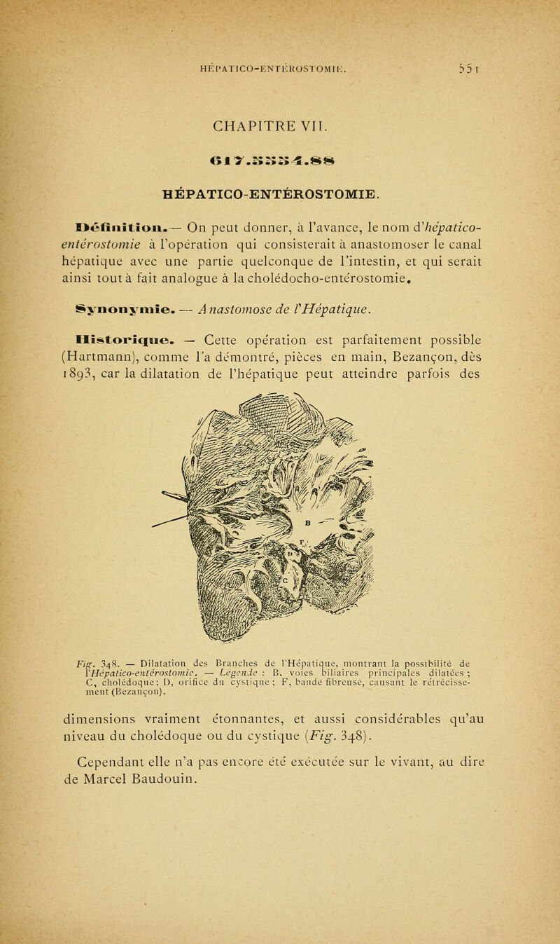 CHAPITRE VII. iilY.îiïiZ>4.HH HEPATICO-ENTEROSTOMIE. Définition.— On peut donner, à l'avance, le nom àliépatico- entérostumie à l'opération qui consisterait à anastomoser le canal hépatique avec une partie quelconque de l'intestin, et qui serait ainsi tout à fait analogue à la cholédocho-entérostomie. •ynonynne. A nastomose de rHépatique. Historique. — Cette opération est parfaitement possible (Hartmann), comme l'a démontré, pièces en main, Bezançon, dès 1893, car la dilatation de l'hépatique peut atteindre parfois des Fig. 348. — Dilatation des Branches de l'Hépatique, montrant la possibilité de X'Hépalico-entérostamie. — Légende : B, voies biliaires principales dilatées ; C, cholédoque; D, orifice du cystique ; F, bande fibreuse, causant le rétrécisse- ment (Bezançon). dimensions vraiment étonnantes, et aussi considérables qu'au niveau du cholédoque ou du cystique [Fig. 348). Cependant elle n'a pas encore été exécutée sur le vivant, au dire de Marcel Baudouin.