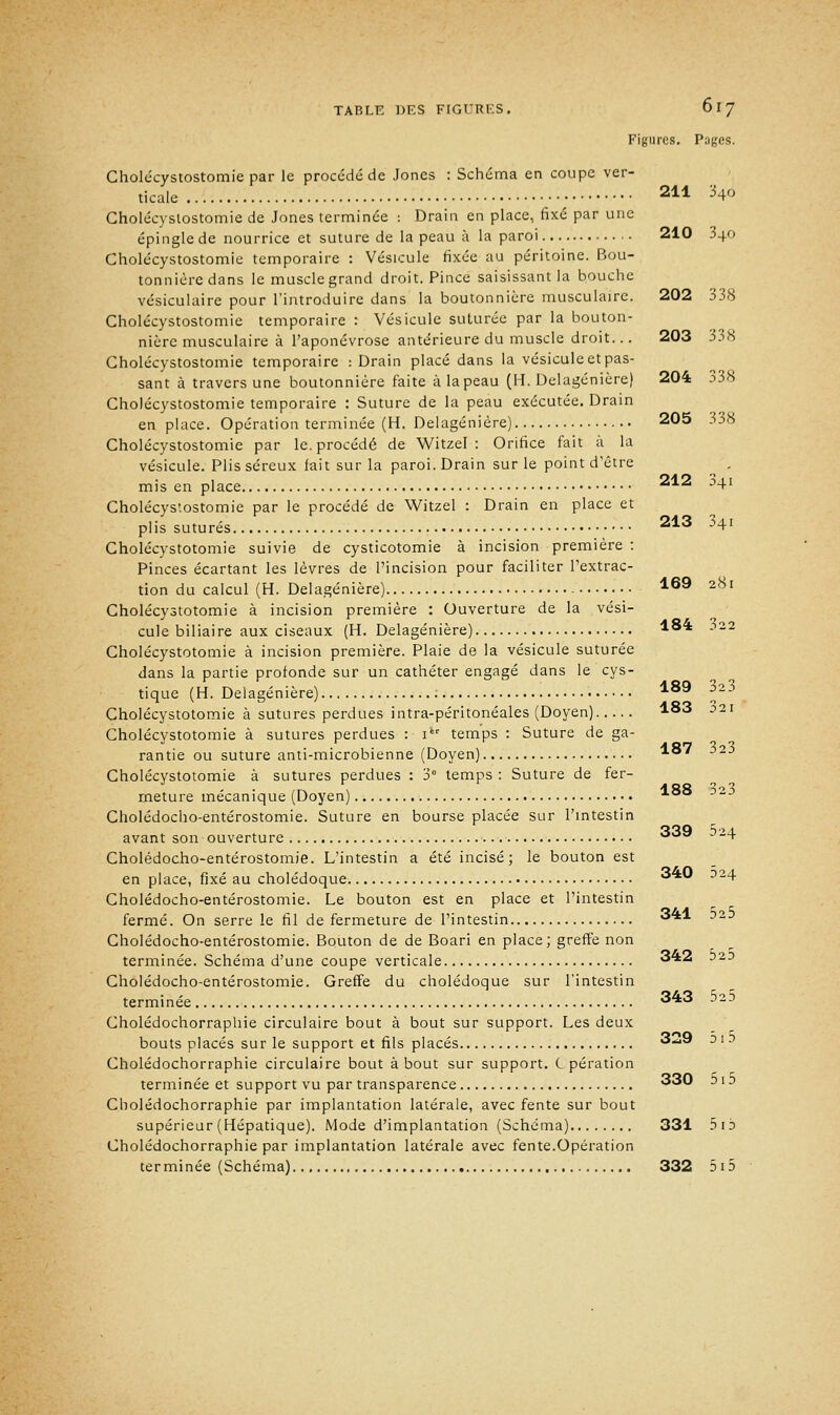 Figures. Pages. Cholécystostomie par le procédé de Jones : Schéma en coupe ver- ticale 211 340 Cholécystostomie de Jones terminée : Drain en place, fixé par une épingle de nourrice et suture de la peau à la paroi 210 340 Cholécystostomie temporaire : Vésicule fixée au péritoine. Bou- tonnière dans le muscle grand droit. Pince saisissant la bouche vésiculaire pour l'introduire dans la boutonnière musculaire. 202 338 Cholécystostomie temporaire : Vésicule suturée par la bouton- nière musculaire à l'aponévrose antérieure du muscle droit... 203 338 Cholécystostomie temporaire : Drain placé dans la vésicule et pas- sant à travers une boutonnière faite à la peau (H. Delagénière) 204 338 Cholécystostomie temporaire : Suture de la peau exécutée. Drain en place. Opération terminée (H. Delagénière) 205 338 Cholécystostomie par le. procédé de Witzel : Orifice fait à la vésicule. Plis séreux fait sur la paroi. Drain sur le point d'être mis en place 212 :,+I Cholécystostomie par le procédé de Witzel : Drain en place et piis suturés 213 '41 Cholécystotomie suivie de cysticotomie à incision première : Pinces écartant les lèvres de l'incision pour faciliter l'extrac- tion du calcul (H. Delagénière) 169 281 Cholécystotomie à incision première : Ouverture de la vési- cule biliaire aux ciseaux (H. Delagénière) *84 322 Cholécystotomie à incision première. Plaie de la vésicule suturée dans la partie profonde sur un cathéter engagé dans le cys- tique (H. Delagénière) ; 189 3 Cholécystotomie à sutures perdues intra-péritonéales (Doyen) *83 021 Cholécystotomie à sutures perdues : i temps : Suture de ga- rantie ou suture anti-microbienne (Doyen) *° ' i2-> Cholécystotomie à sutures perdues : 3° temps : Suture de fer- meture mécanique (Doyen) *88 -'2;> Cholédocho-entérostomie. Suture en bourse placée sur l'intestin ooq 5.,, avant son ouverture ^^^ ~+ Cholédocho-entérostomie. L'intestin a été incisé; le bouton est en place, fixé au cholédoque 3*0 D24 Cholédocho-entérostomie. Le bouton est en place et l'intestin fermé. On serre le fil de fermeture de l'intestin 341 ■>2-> Cholédocho-entérostomie. Bouton de de Boari en place; greffe non terminée. Schéma d'une coupe verticale 342 oio Cholédocho-entérostomie. Greffe du cholédoque sur l'intestin terminée 343 010 Cholédochorraphie circulaire bout à bout sur support. Les deux bouts placés sur le support et fils placés 3«a9 oi d Cholédochorraphie circulaire bout à bout sur support, opération terminée et support vu par transparence 330 5 1 b Cholédochorraphie par implantation latérale, avec fente sur bout supérieur (Hépatique). Mode d'implantation (Schéma) 331 5ib Cholédochorraphie par implantation latérale avec fente.Opération terminée (Schéma) 332 5 15