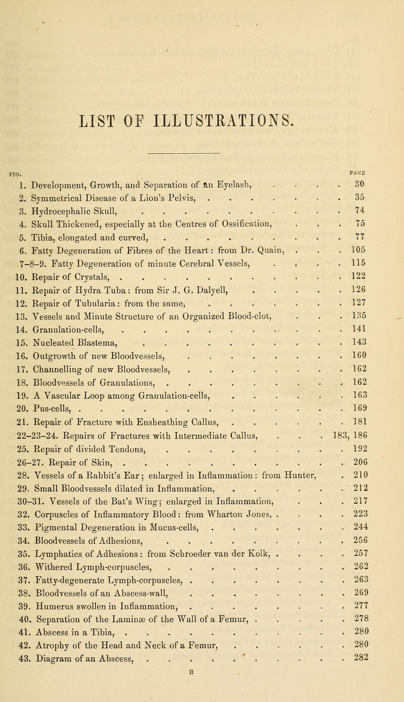LIST OE ILLUSTEATIONS. 1. Development, Growth, and Separation of an Eyelash, 2. Symmetrical Disease of a Lion's Pelvis, 3. Hydrocephalic Skull, ...... 4. Skull Thickened, especially at the Centres of Ossification, 5. Tibia, elongated and curved, ..... 6. Fatty Degeneration of Fibres of the Heart: from Dr. Quain, 7-8-9. Fatty Degeneration of minute Cerebral Vessels, 10. Repair of Crystals, ....... 11. Repair of Hydra Tuba: from Sir J. G. Dalyell, 12. Repair of Tubularia: from the same, 13. Vessels and Minute Structure of an Organized Blood-clot, 14. Granulation-cells, 15. Nucleated Blastema, 16. Outgrowth of new Bloodvessels, 17. Channelling of new Bloodvessels, 18. Bloodvessels of Granulations, 19. A Vascular Loop among Granulation-cells, 20. Pus-cells, 21. Repair of Fracture with Ensheathing Callus, 22-23-24. Repairs of Fractures with Intermediate Callus, 25. Repair of divided Tendons, ..... 26-27. Repair of Skin, 28. Vessels of a Rabbit's Ear ; enlarged in Inflammation : from Hunter, 29. Small Bloodvessels dilated in Inflammation, 30-31. Vessels of the Bat's Wing; enlarged in Inflammation, 32. Corpuscles of Inflammatory Blood: from Wharton Jones, 33. Pigmental Degeneration in Mucus-cells, 34. Bloodvessels of Adhesions, . ... 35. Lymphatics of Adhesions : from Schroeder van der Kolk, 36. Withered Lymph-corpuscles, ..... 37. Fatty-degenerate Lymph-corpuscles, . 38. Bloodvessels of an Abscess-wall, .... 39. Humerus swollen in Inflammation, .... 40. Separation of the Laminae of the Wall of a Femur, . 41. Abscess in a Tibia, ....... 42. Atrophy of the Head and Neck of a Femur, 43. Diagram of an Abscess, ' . B PAGE 30 35 74 75 77 105 115 122 126 127 135 141 143 160 162 162 163 169 181 183, 186 192 206 210 212 217 223 244 256 257 262 263 269 277 278 280 280 282